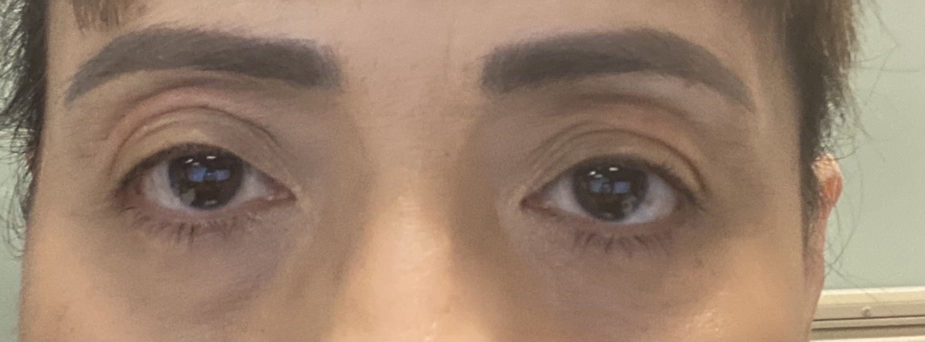 Customer carousel item 11.