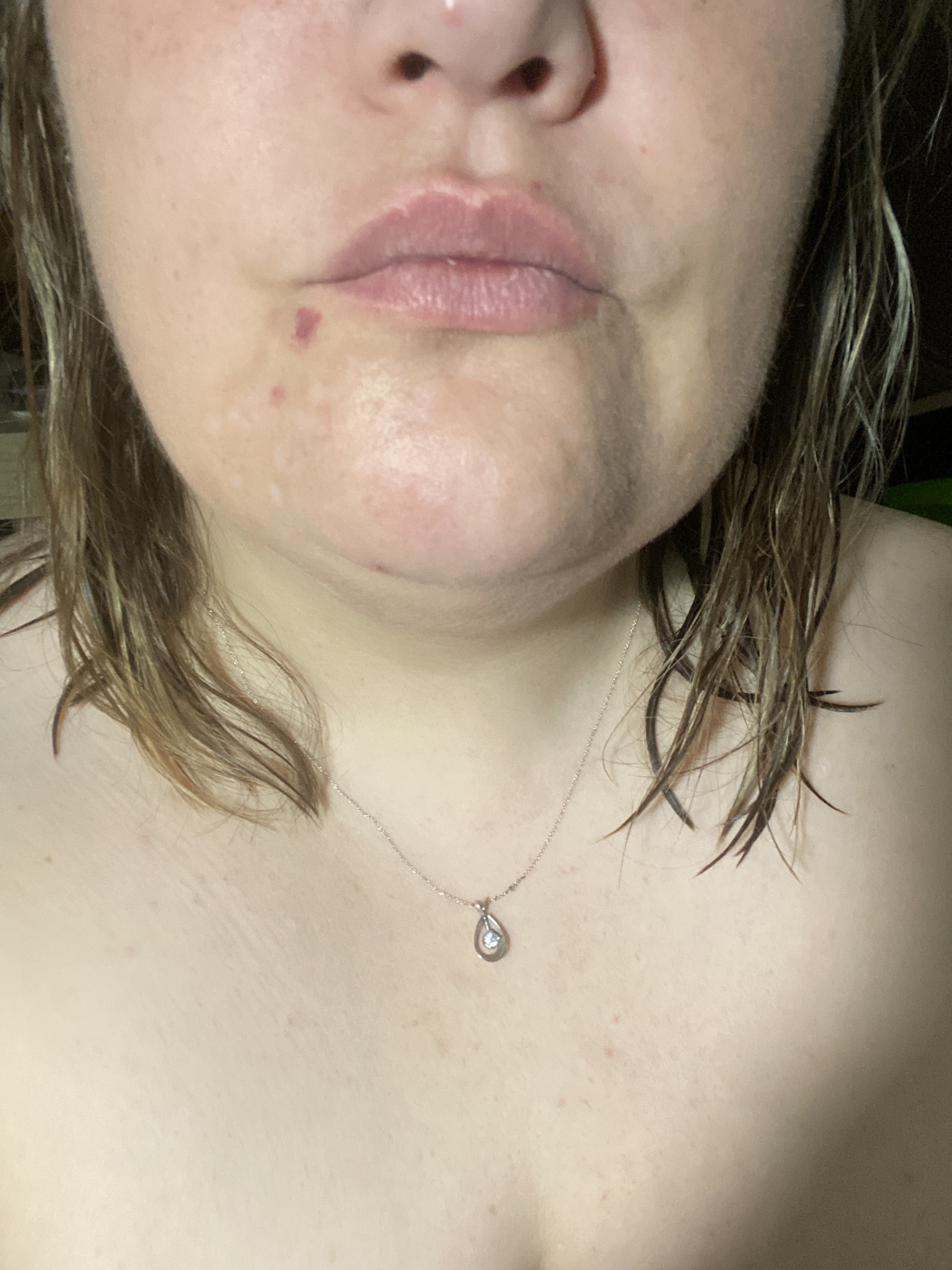 The white marks use to be 10x worse