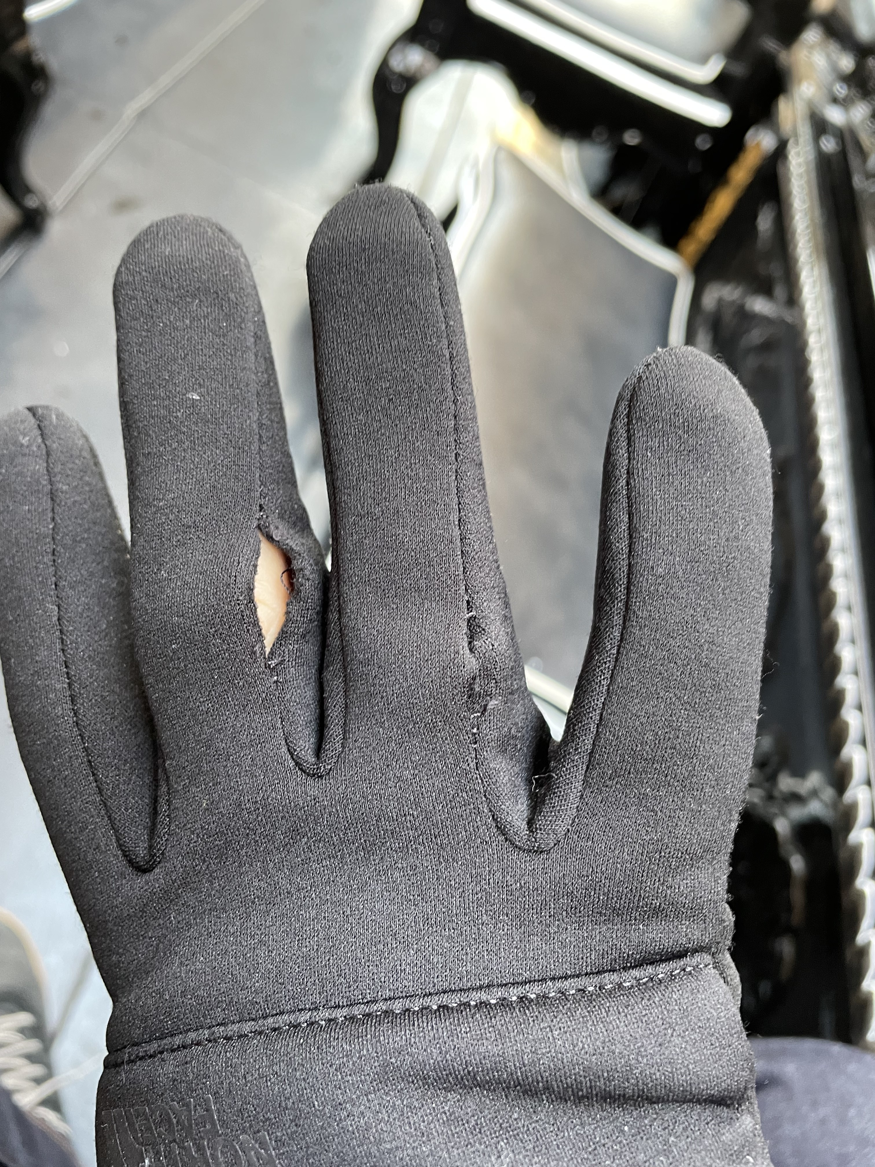 knuckles on several fingers (both hands) became loose.