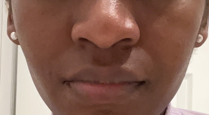 Customer carousel item 11.