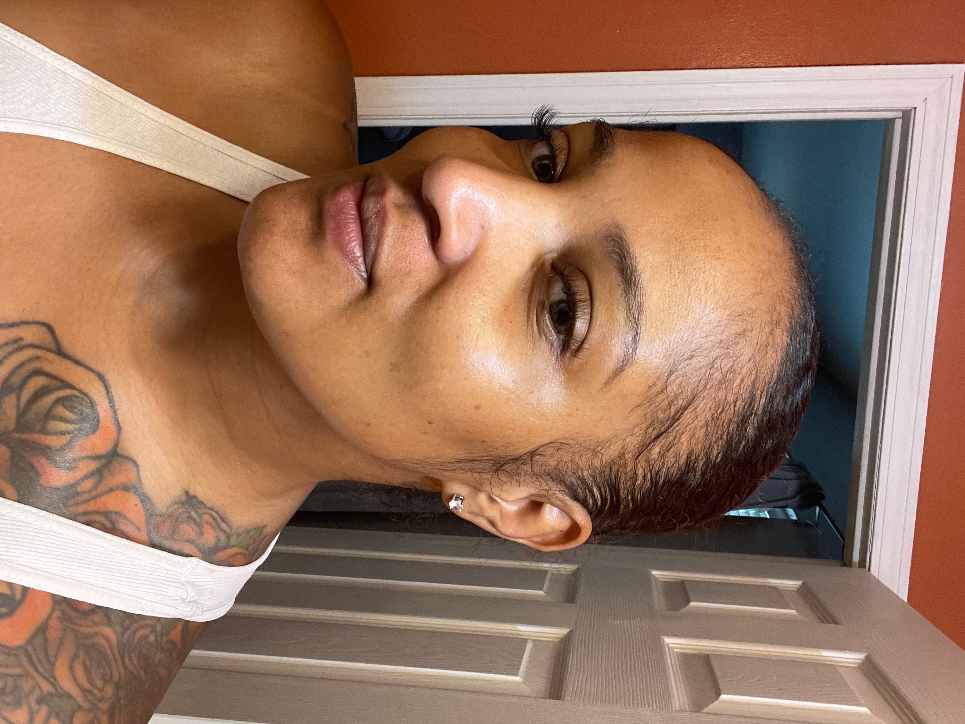 2 weeks of using cream