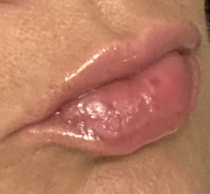 Big lips