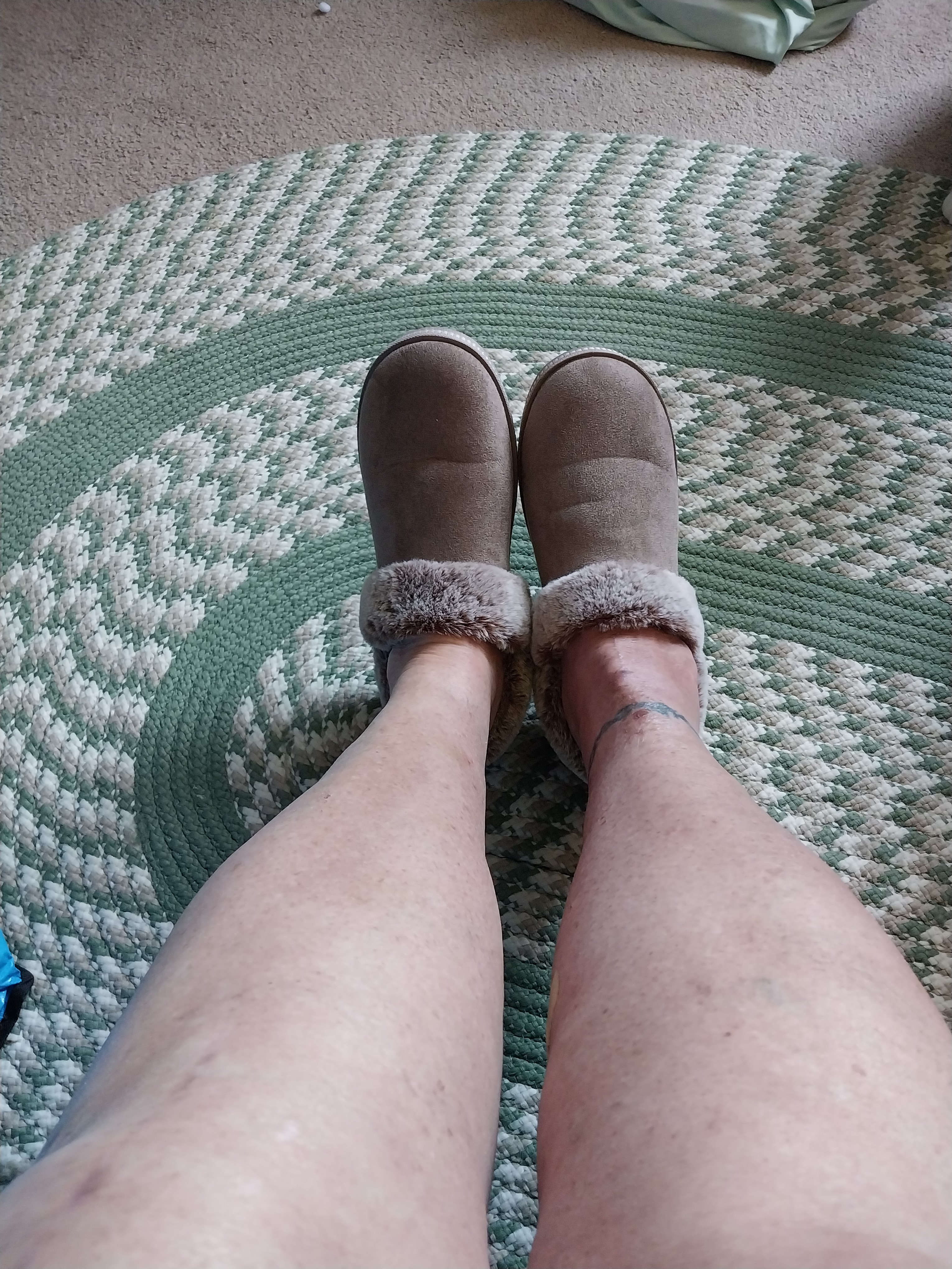 I just had an ankle replacement. Even with all the swelling, they still fit