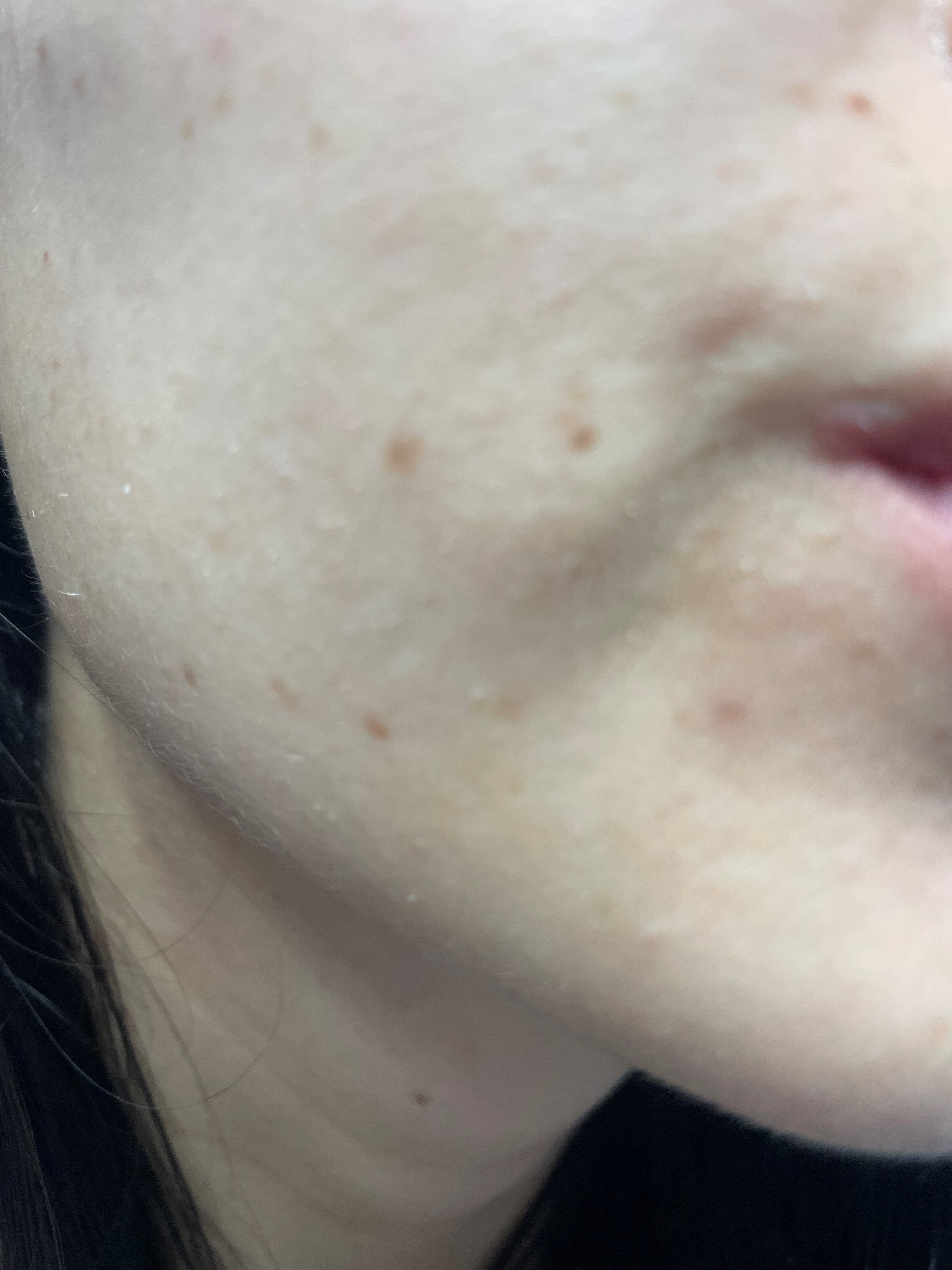 Customer carousel item 6.