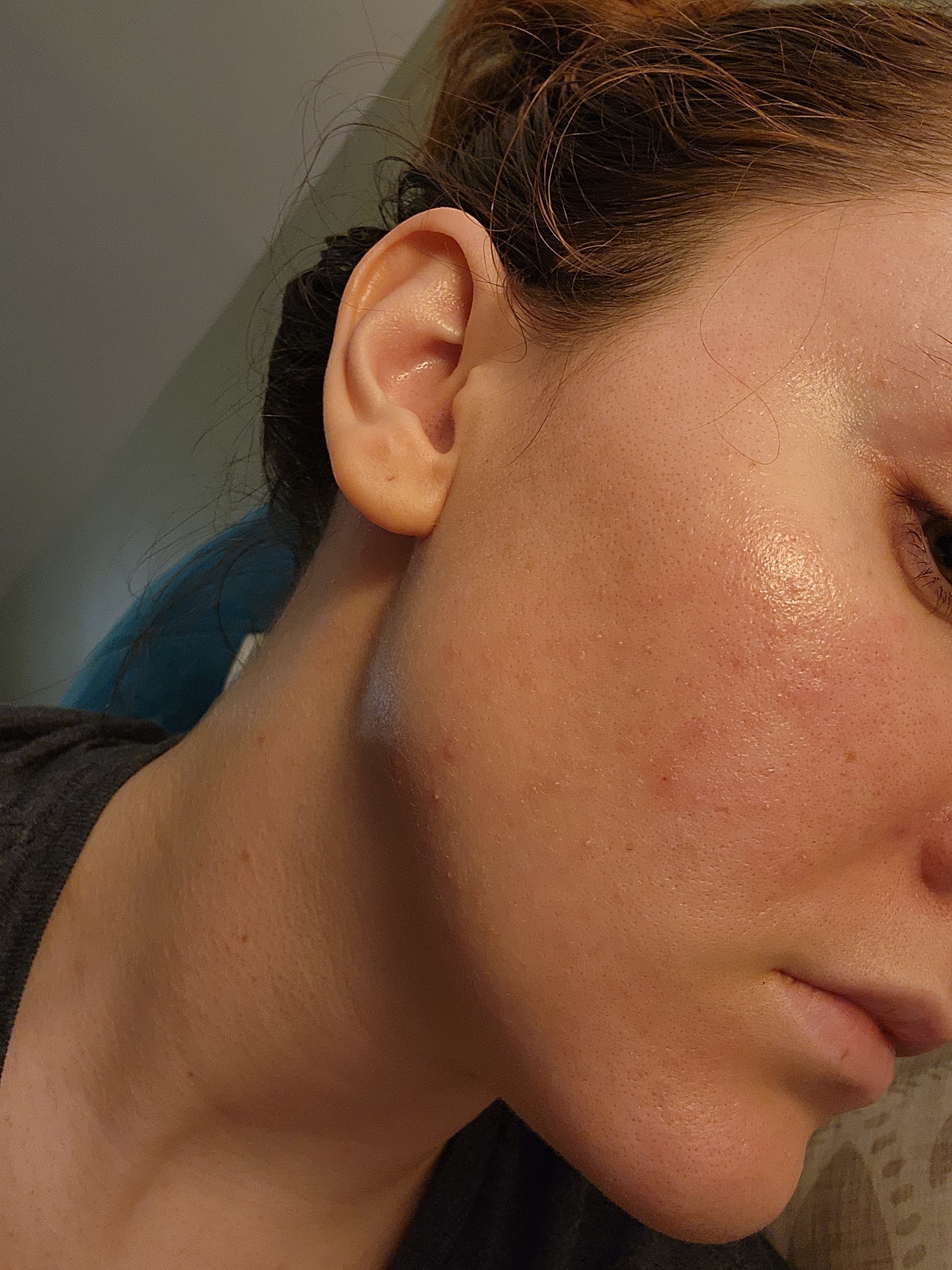 Even went down my neck and on my forehead and eyelids