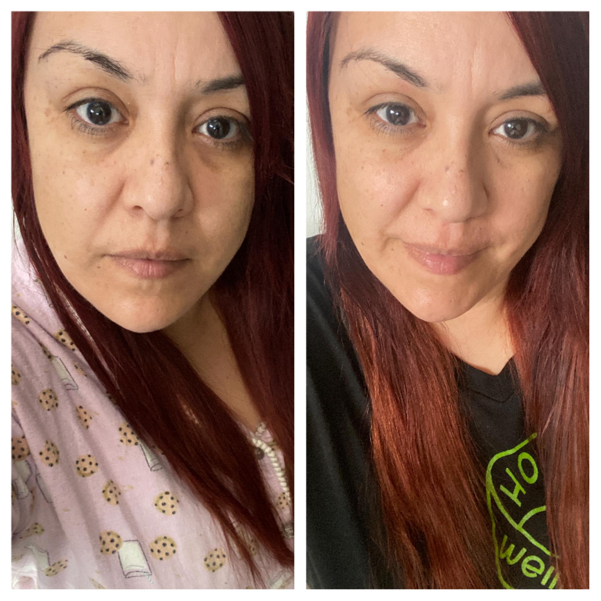 Customer carousel item 1.