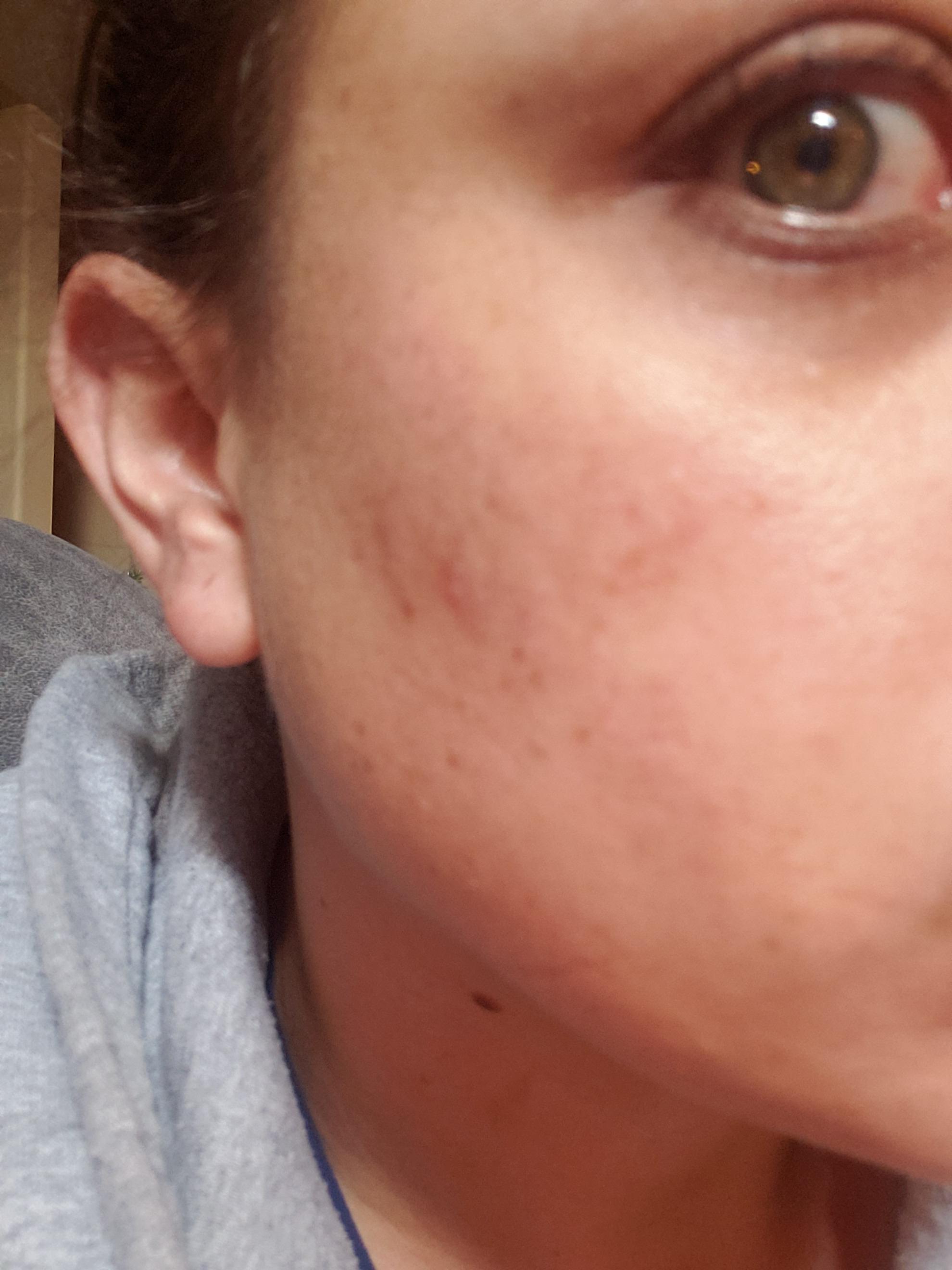 Customer carousel item 3.