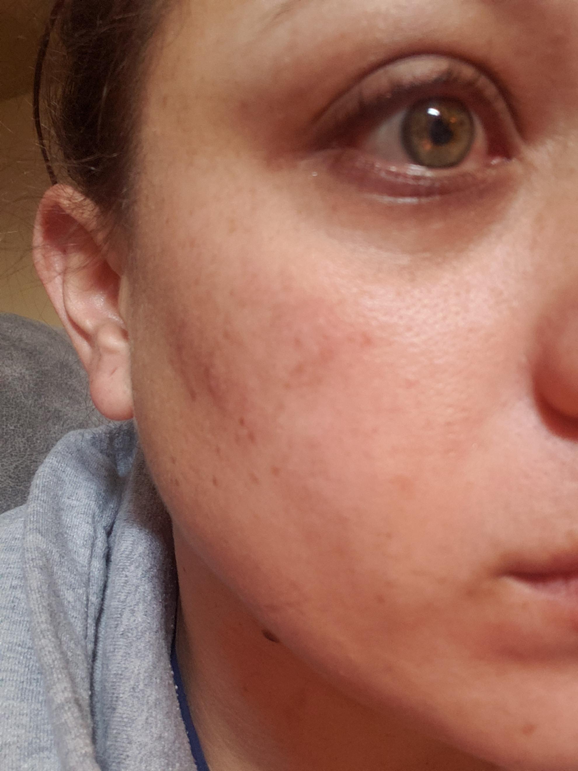 Customer carousel item 2.