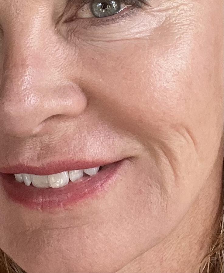 Customer carousel item 1.