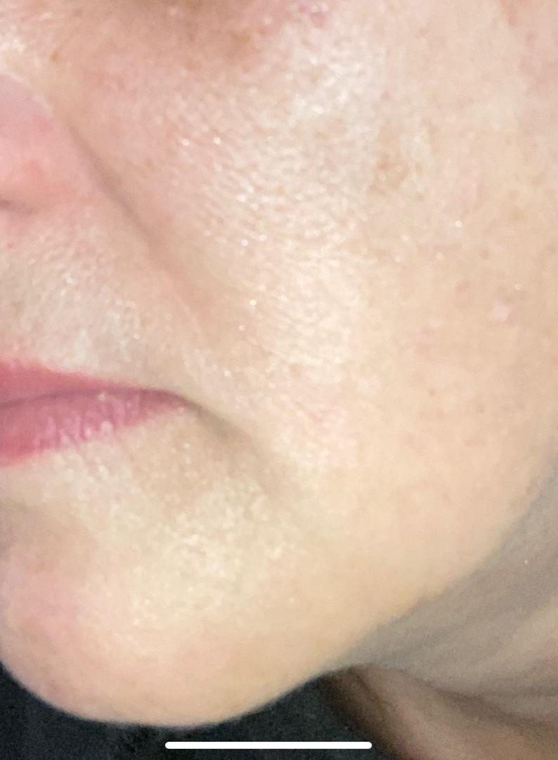 Customer carousel item 11.