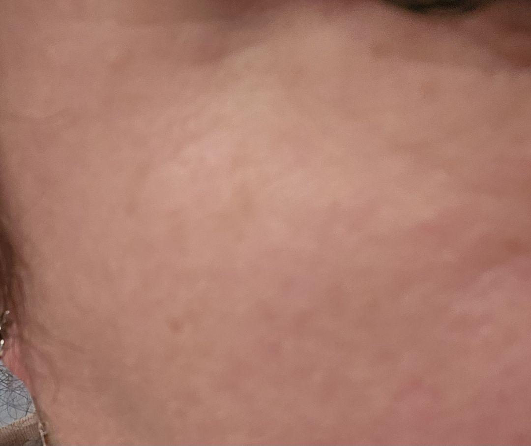 Customer carousel item 13.