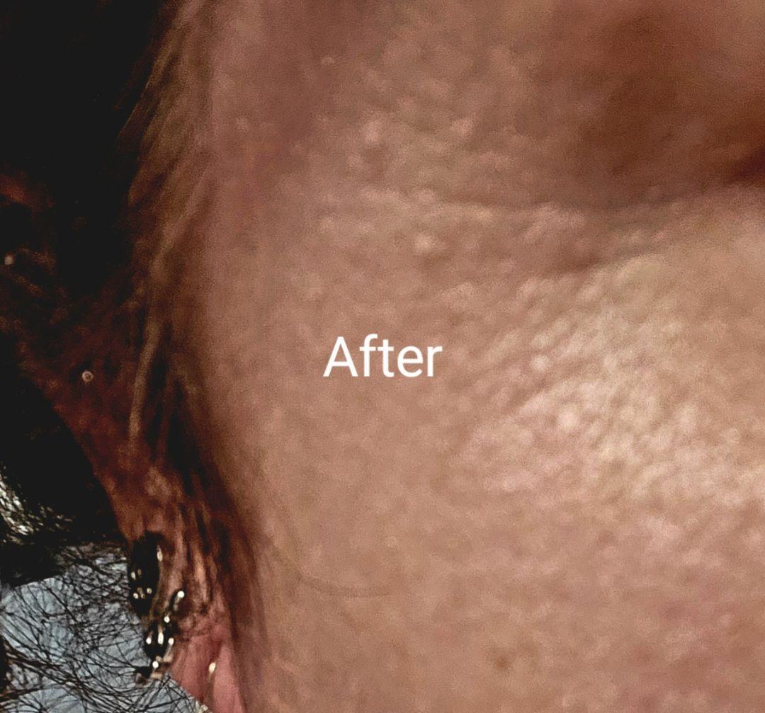 Customer carousel item 11.