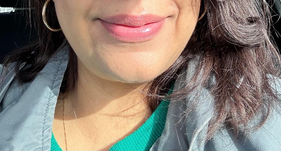 Customer carousel item 11.