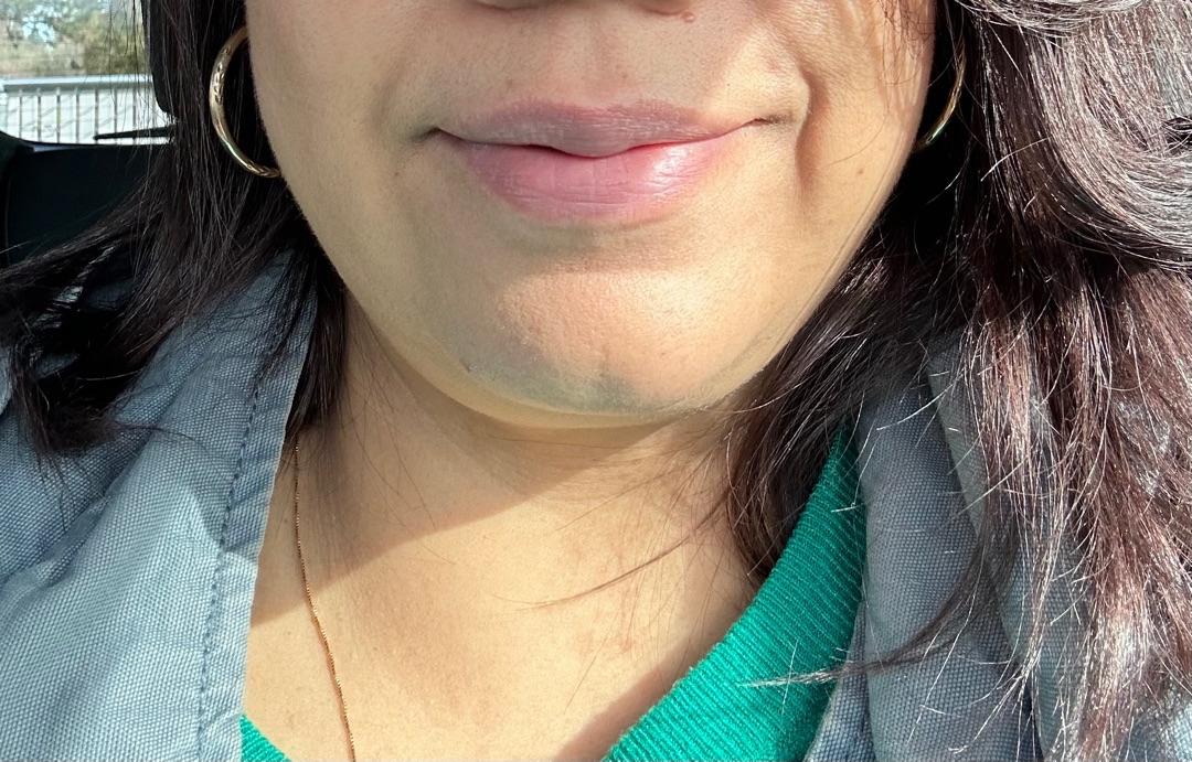 Customer carousel item 13.