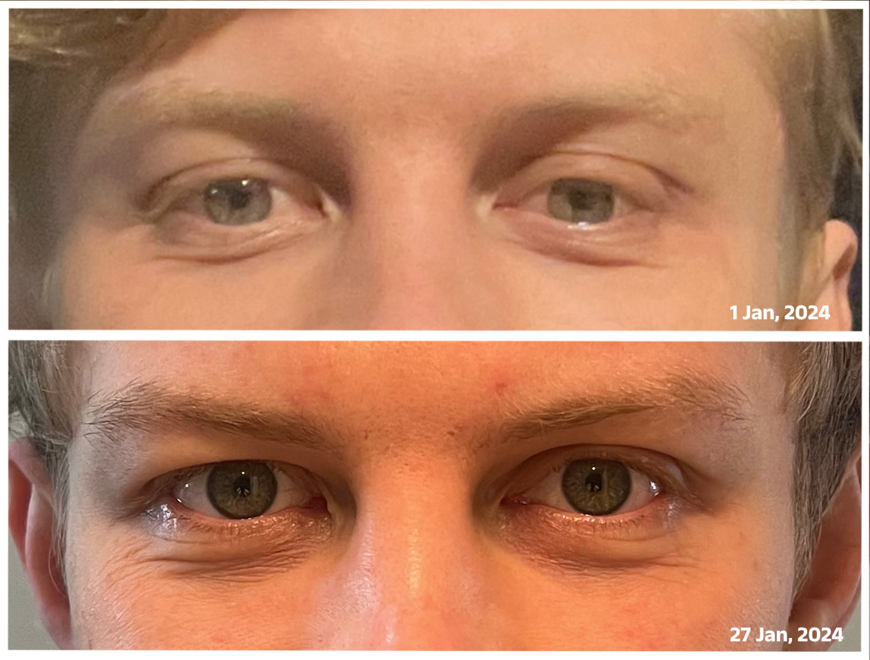 Before and After