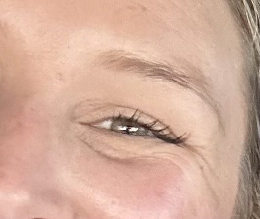 undereyes are dewier, fewer lines, deeply hydrated