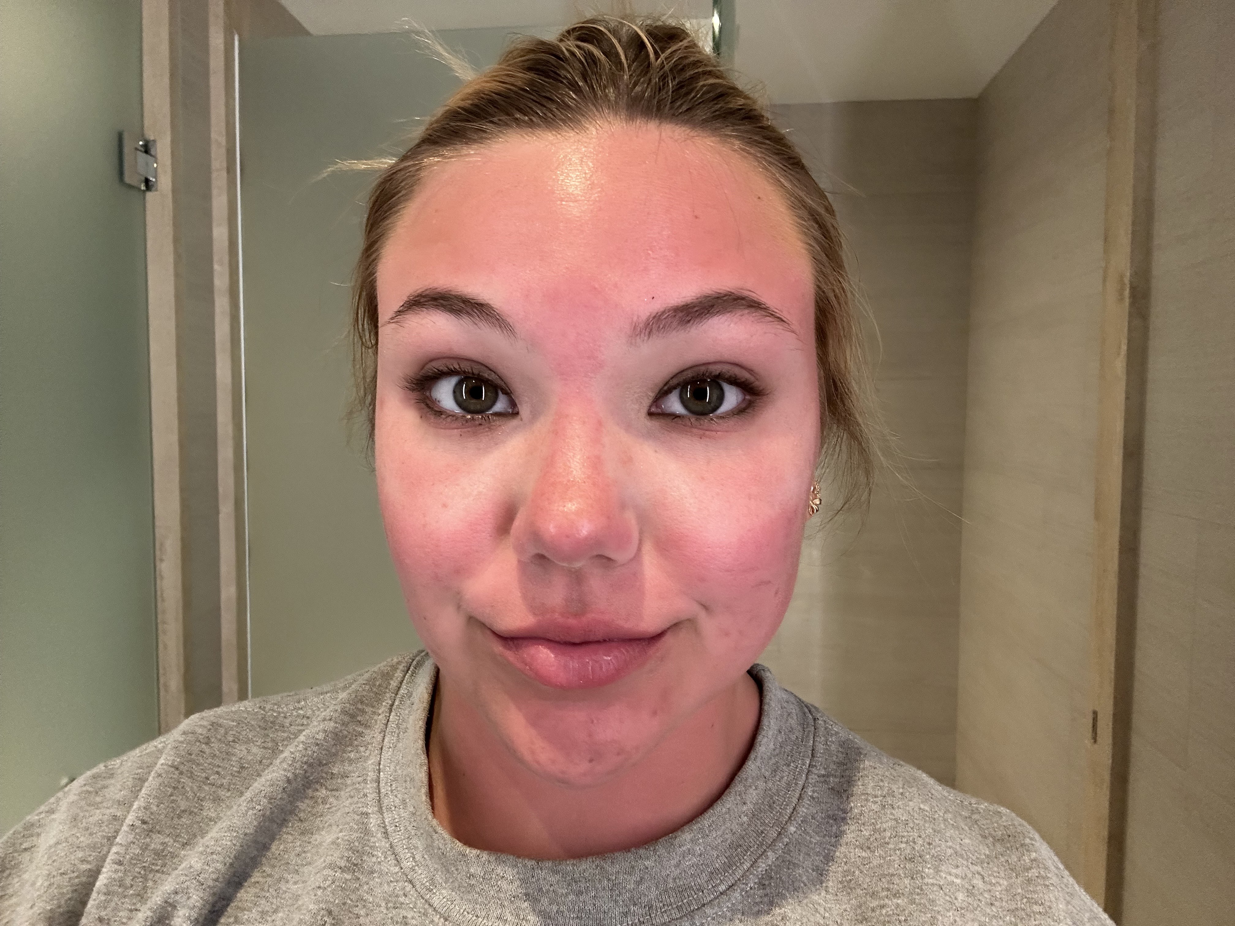 Non-burnt areas result of product usage