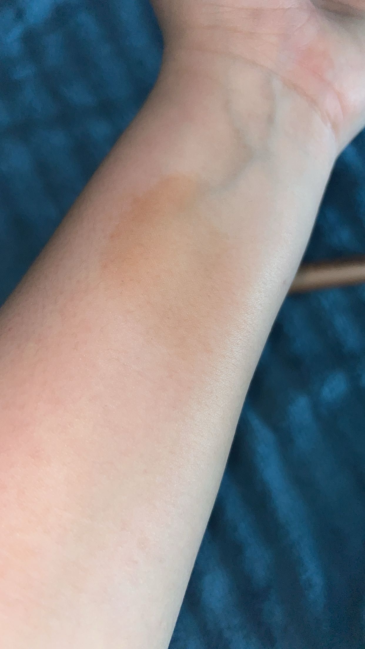 Customer carousel item 11.