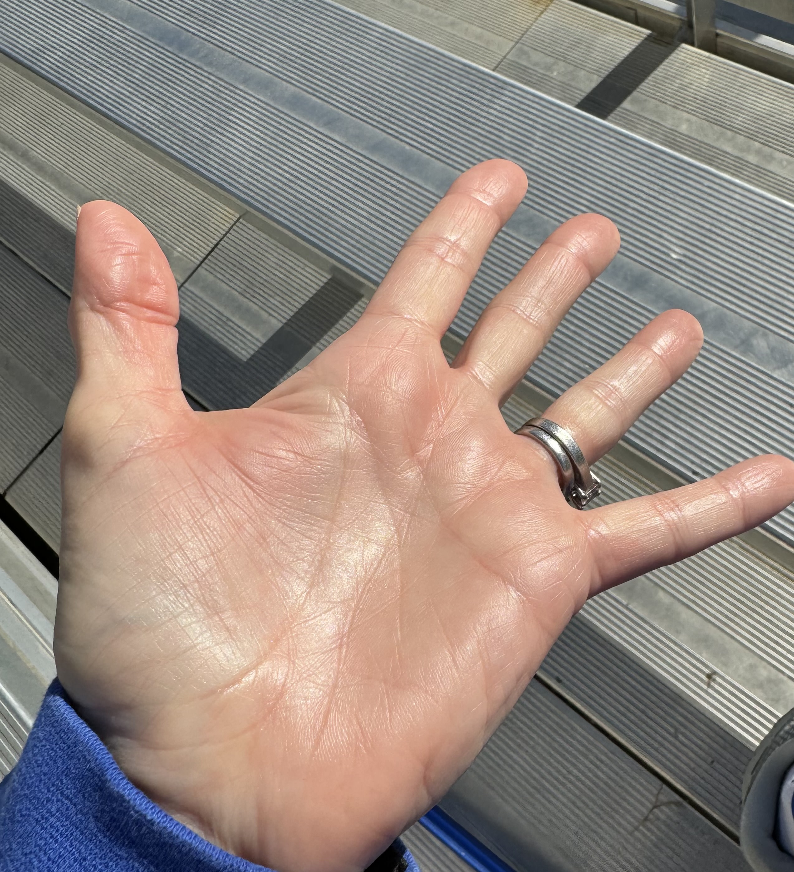 But then it absorbed!