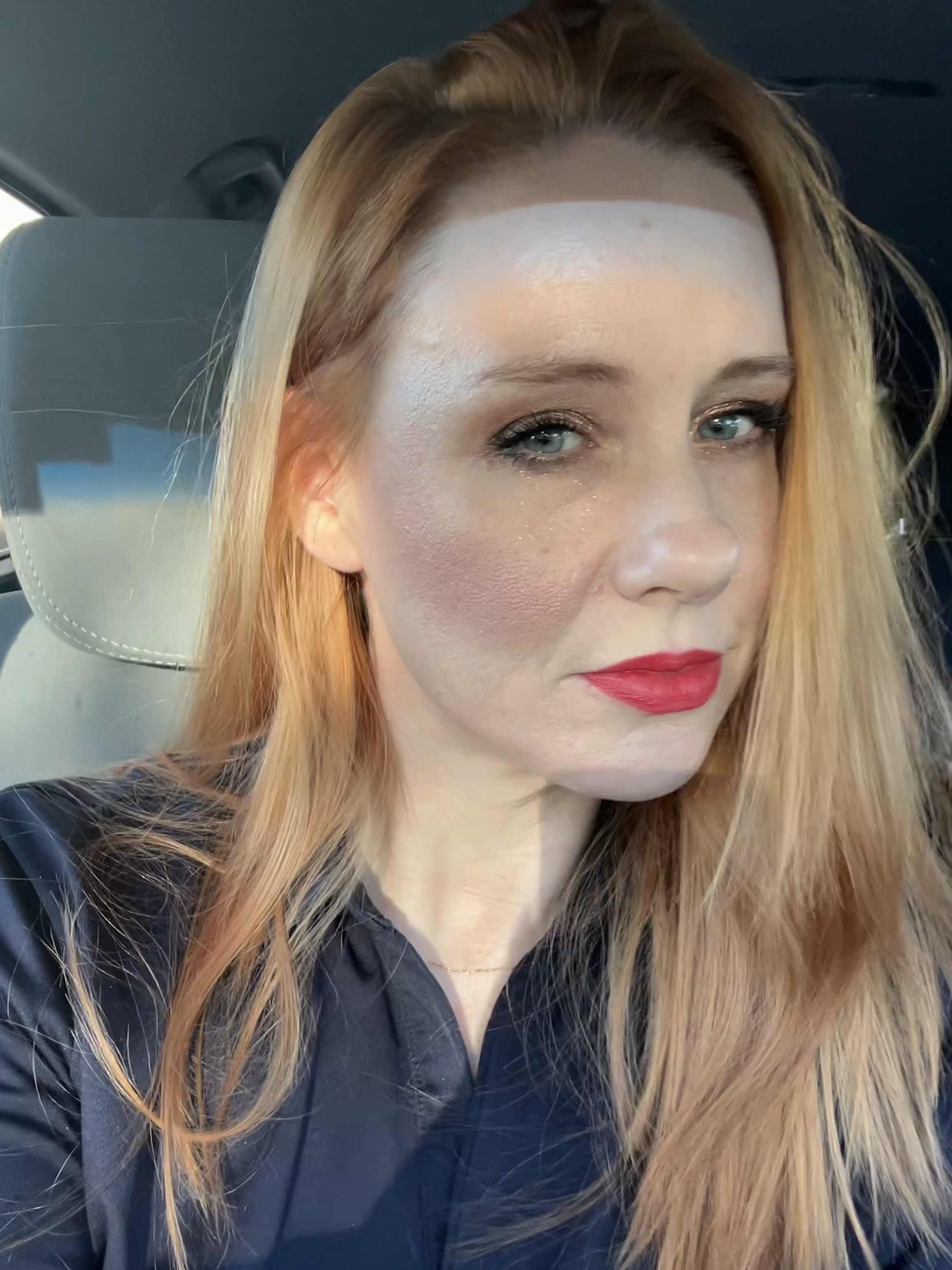 Fair skin prone to freckles and burns easy