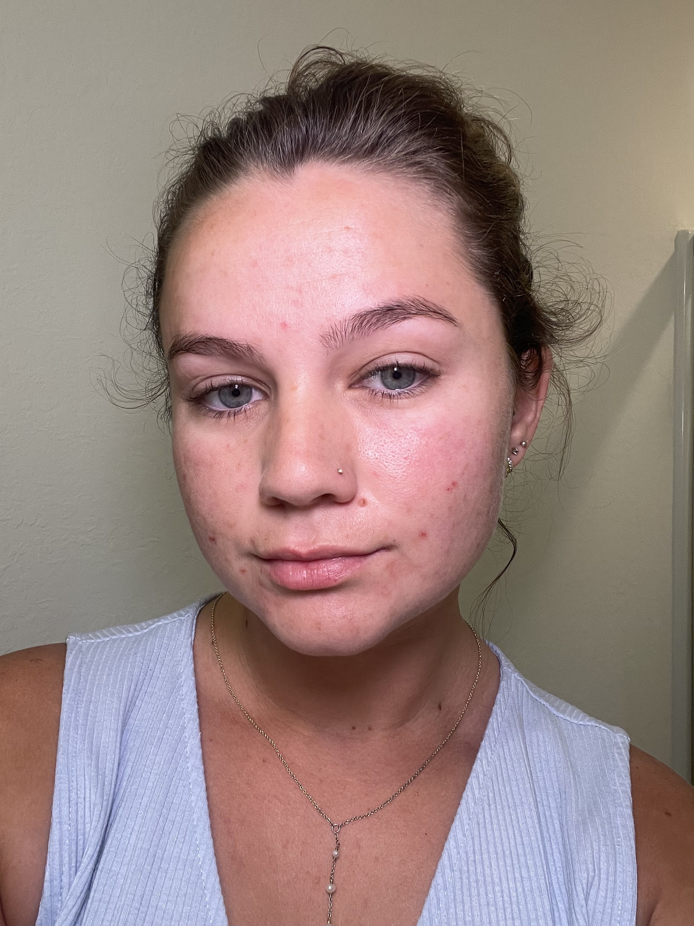 Before applying to cheeks (Nose already done)