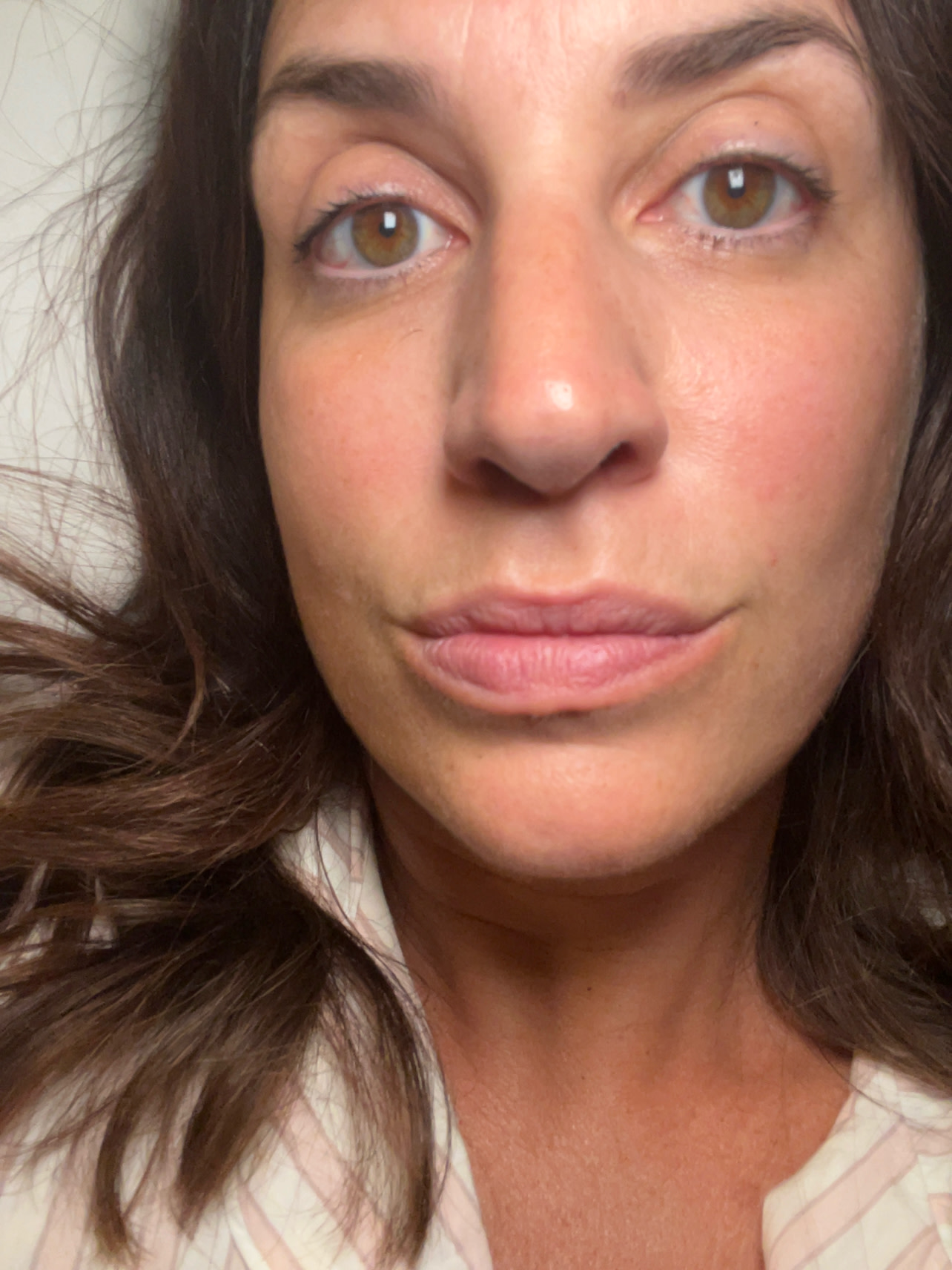 The morning after the night before using the amazing new ANR Overnight Treatment