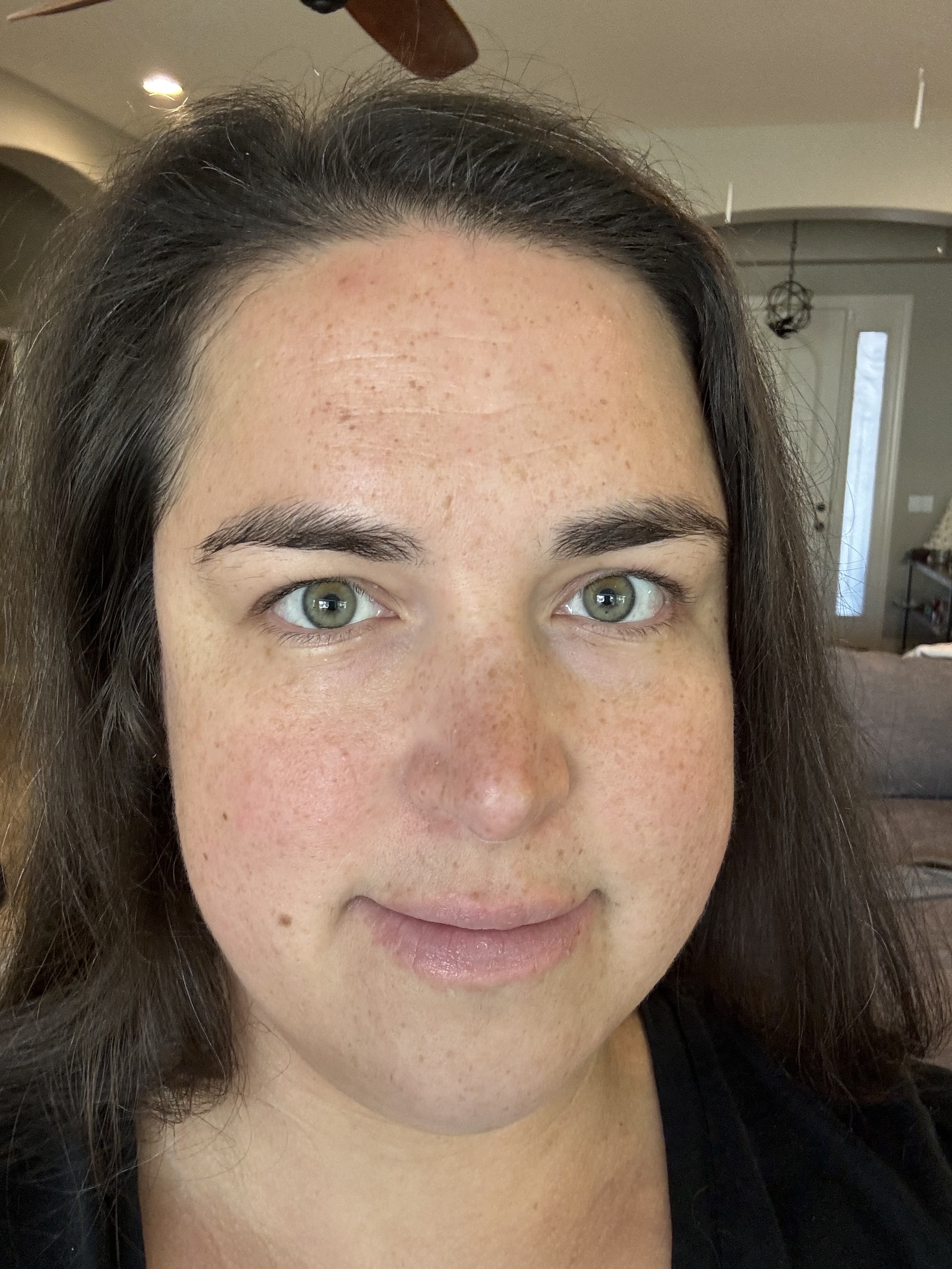 My skin after using toner. I was surprised to see an immediate difference!