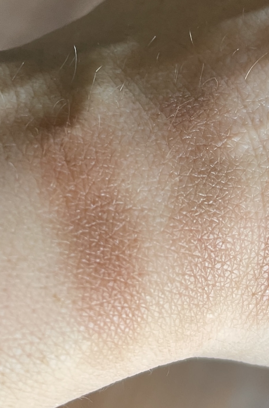 Customer carousel item 11.