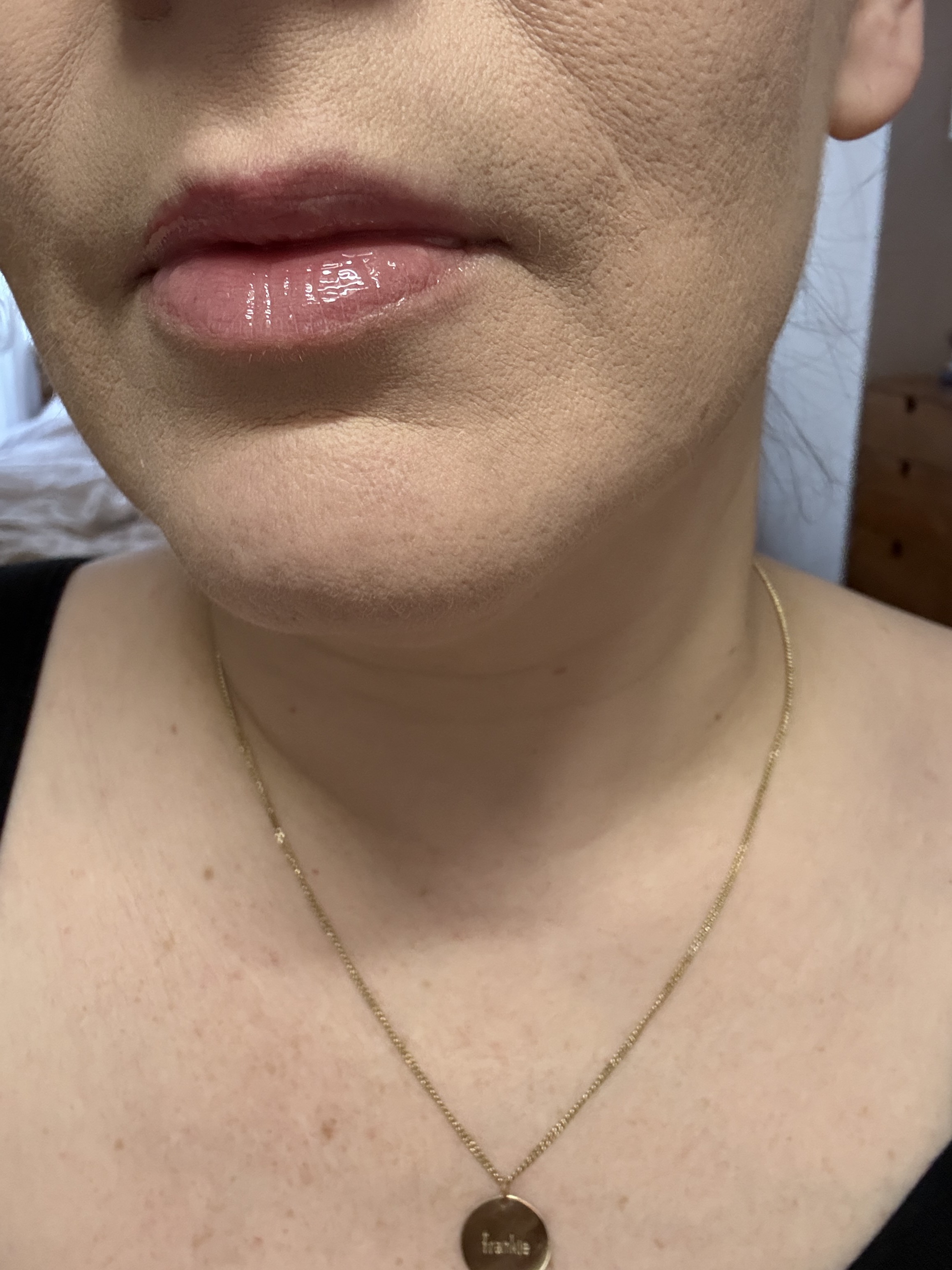 Customer carousel item 10.