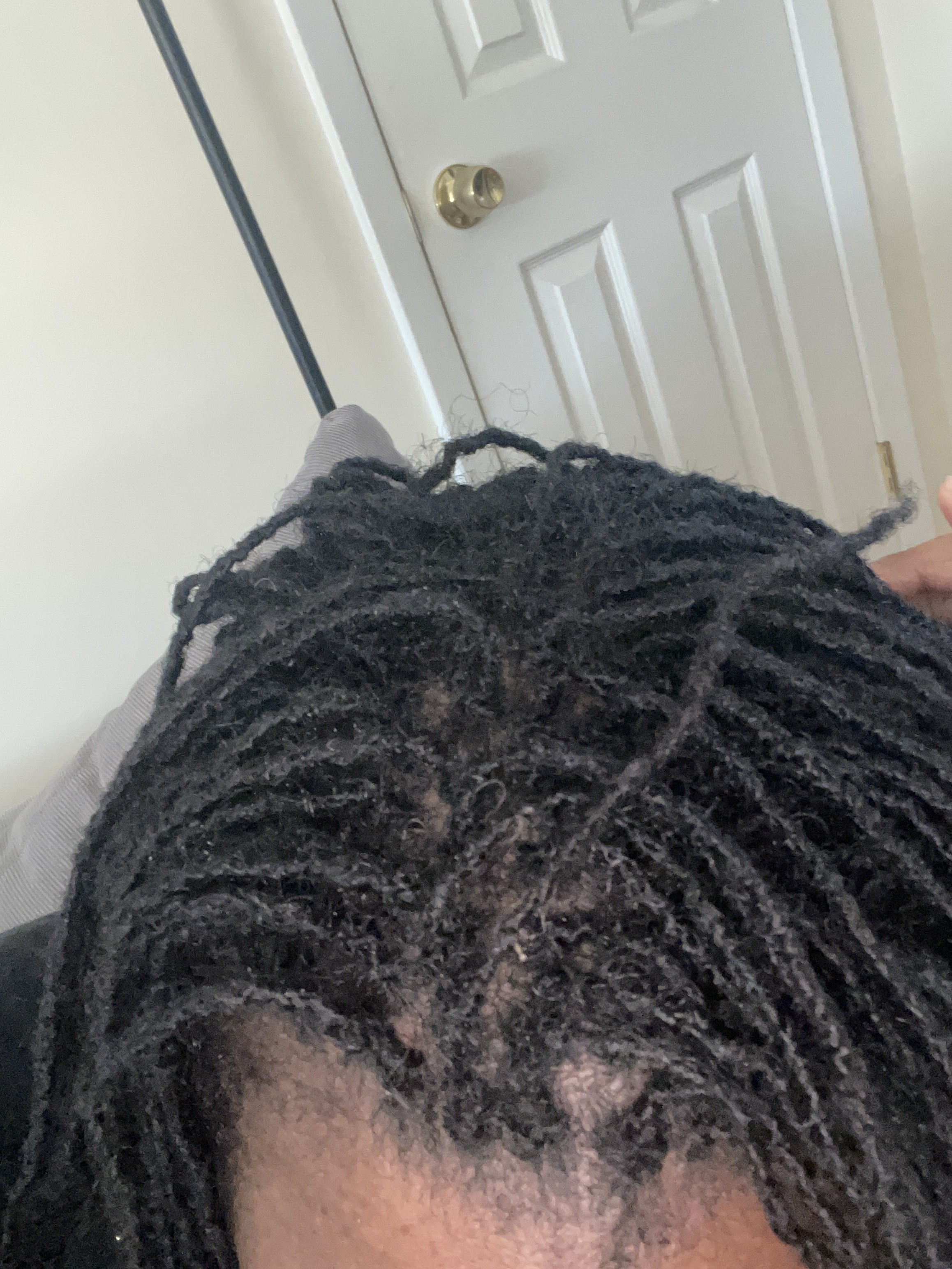 Flakes 2 days post wash