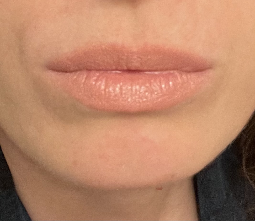 Customer carousel item 12.