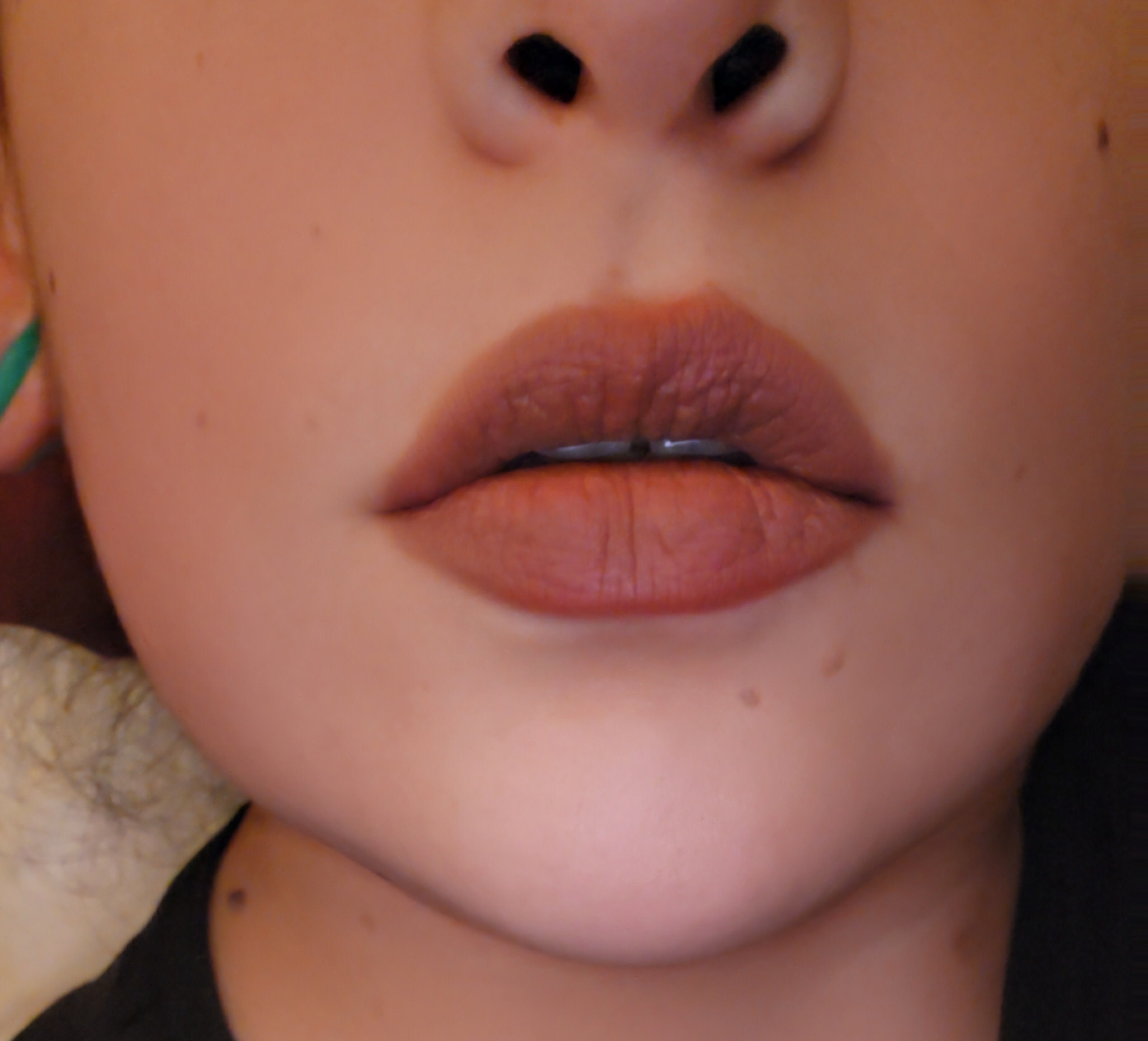 Customer carousel item 11.