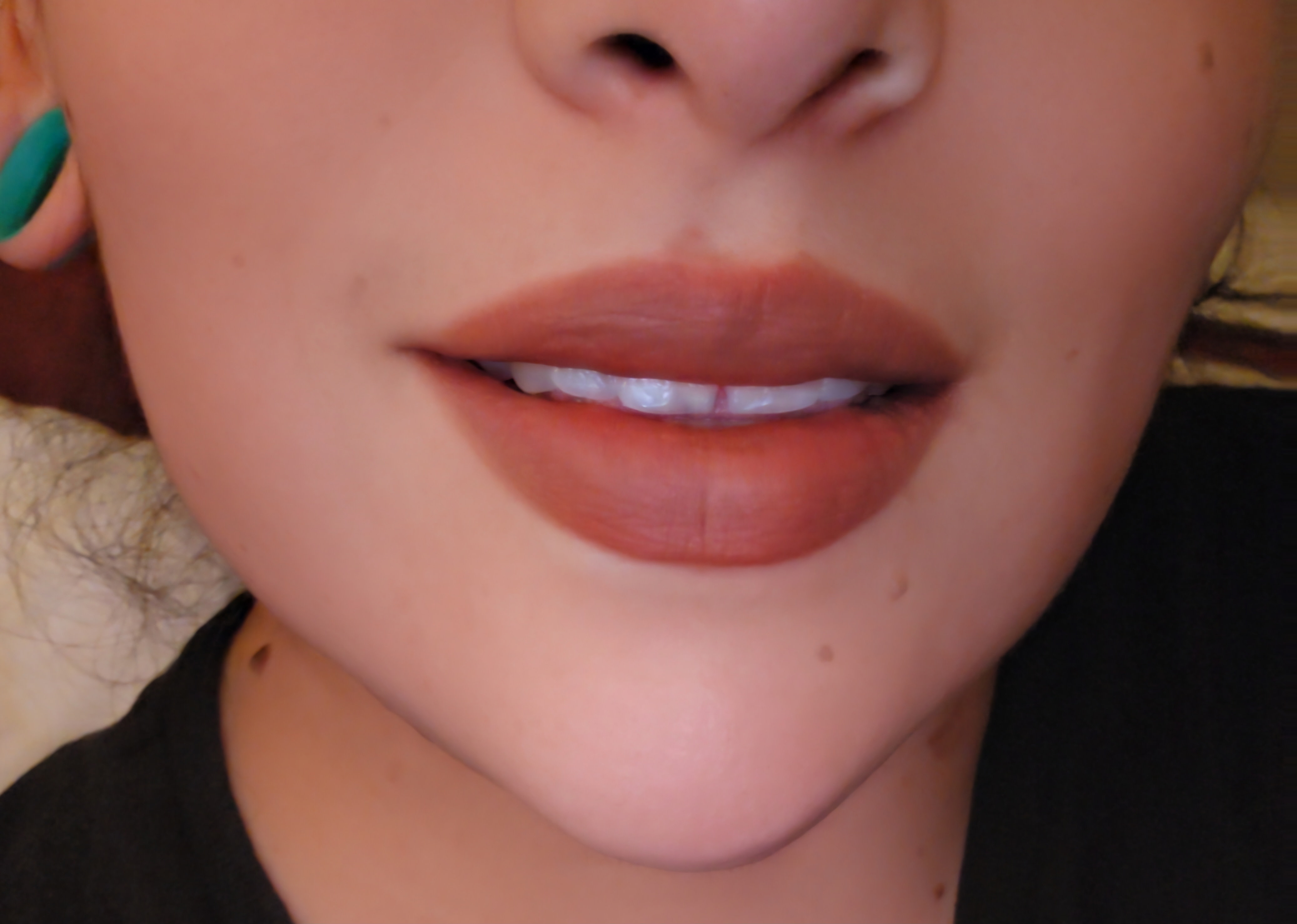 Customer carousel item 10.