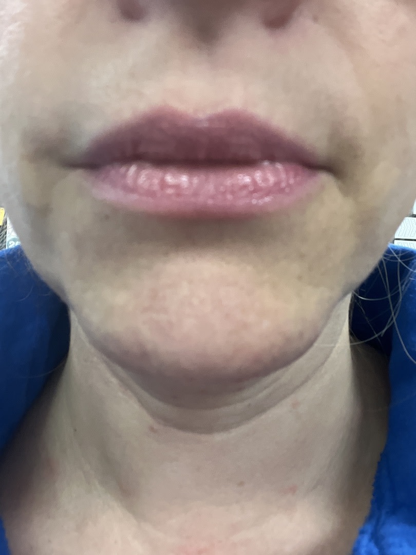 Customer carousel item 2.