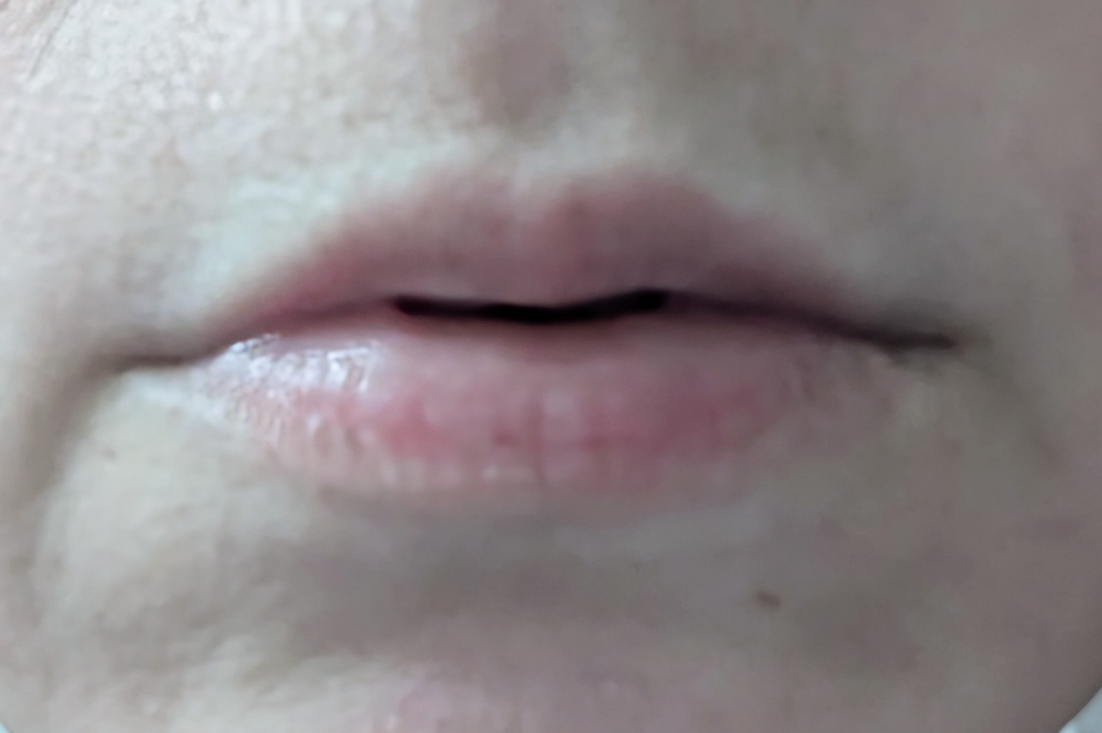 Before lip oil. Pale, dry lips