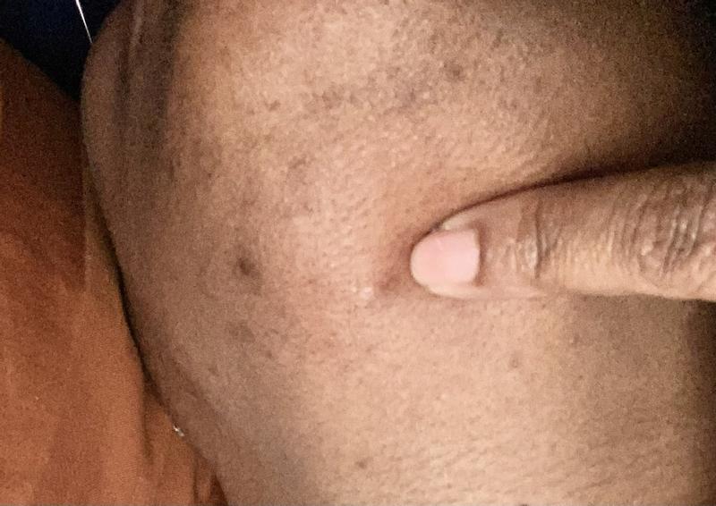 Customer carousel item 1.