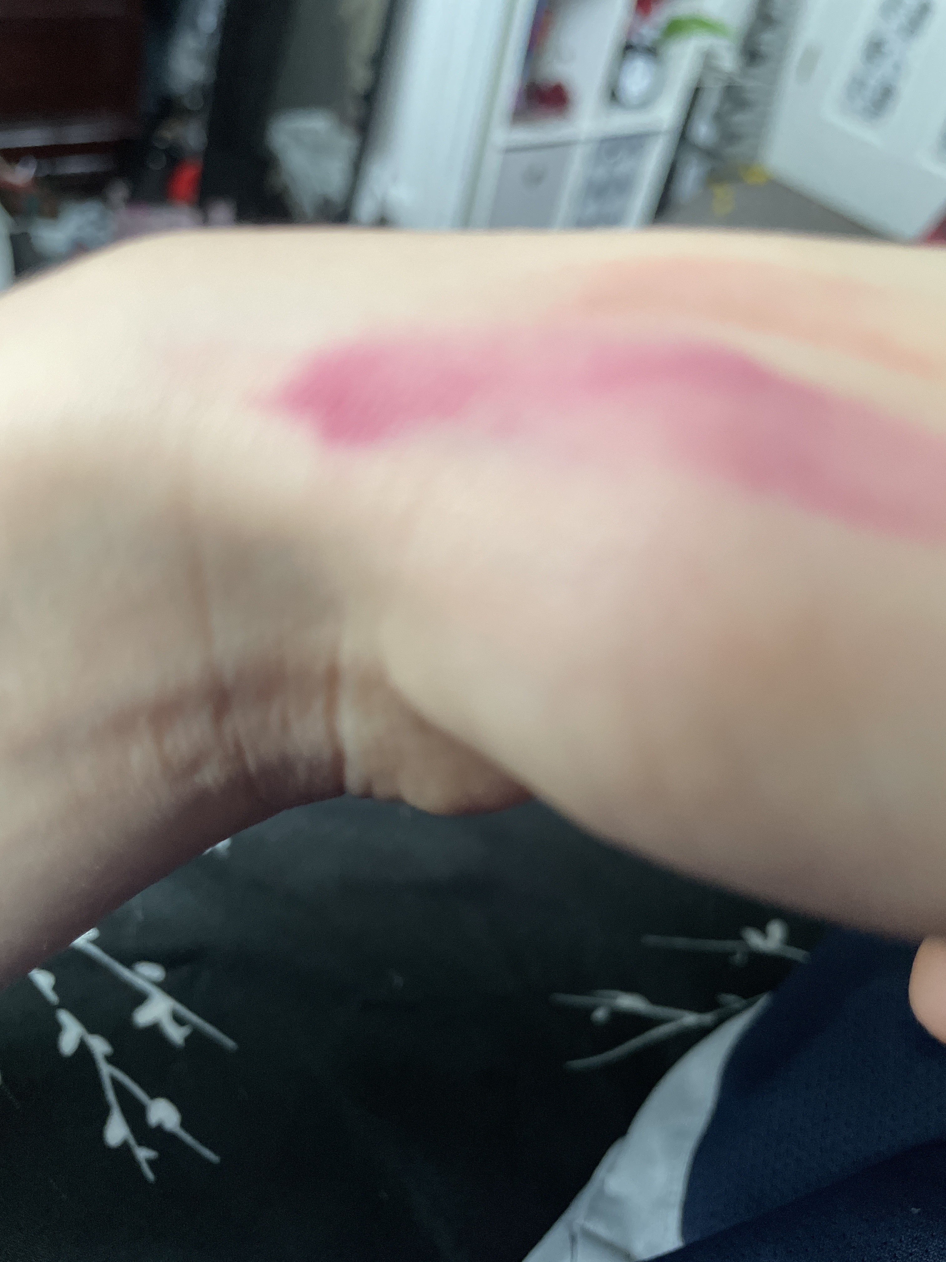 purple stain from swatch test