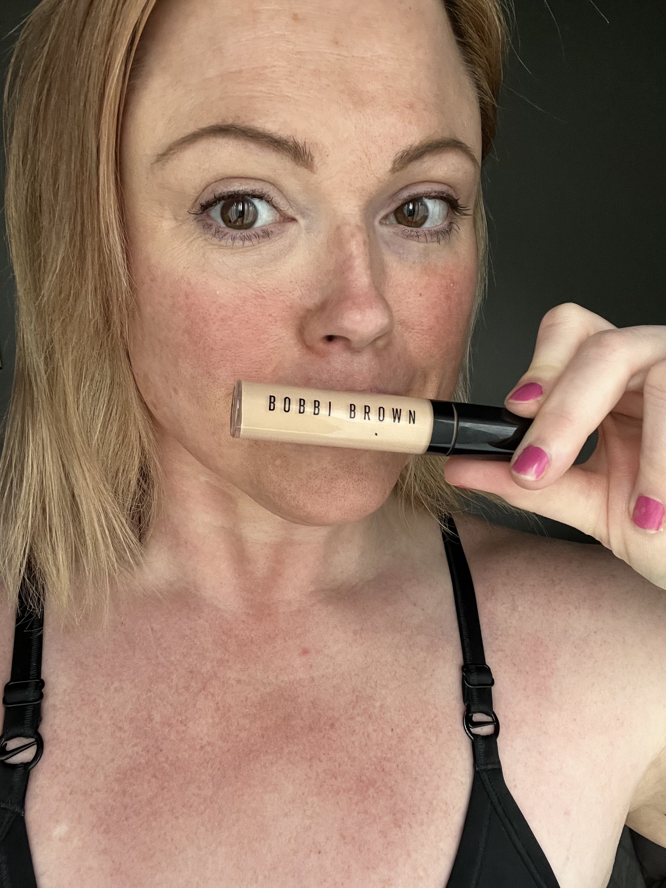 Left eye has been concealed the right has not.