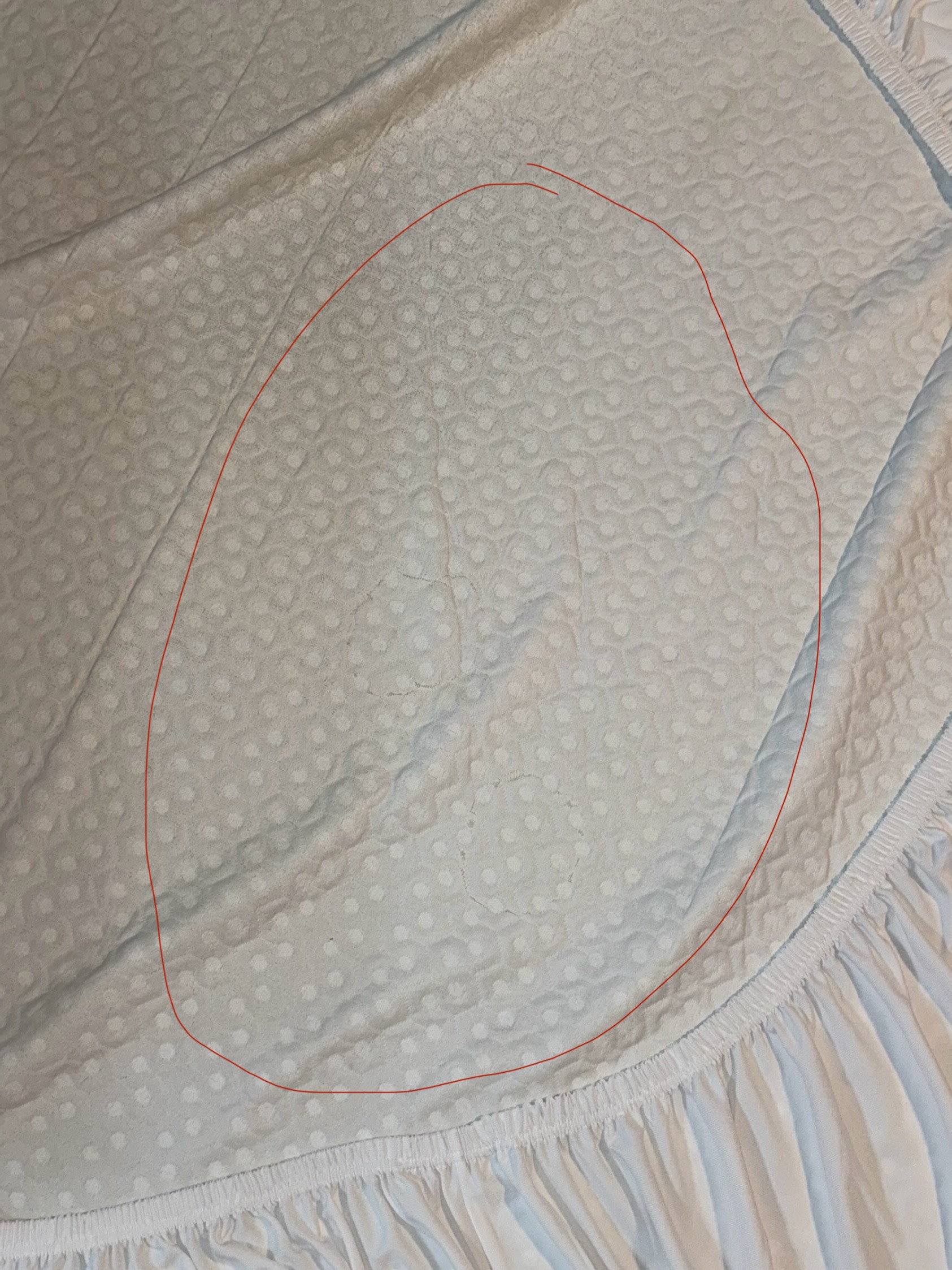 This picture is the reason they denied my claim