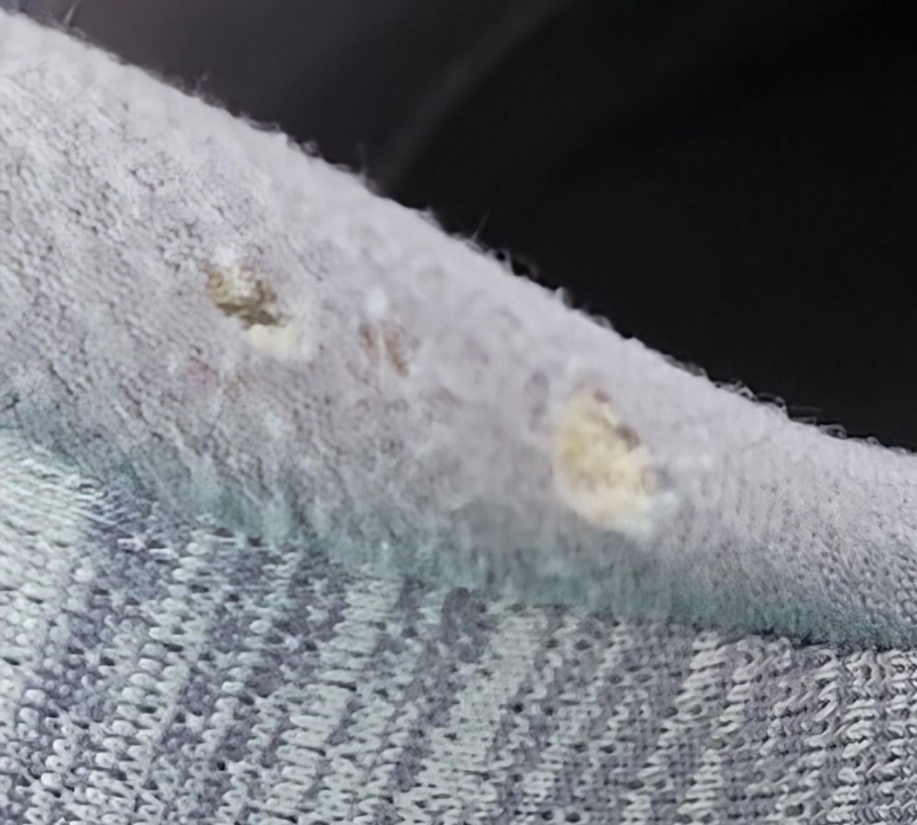 The holes that i mentioned