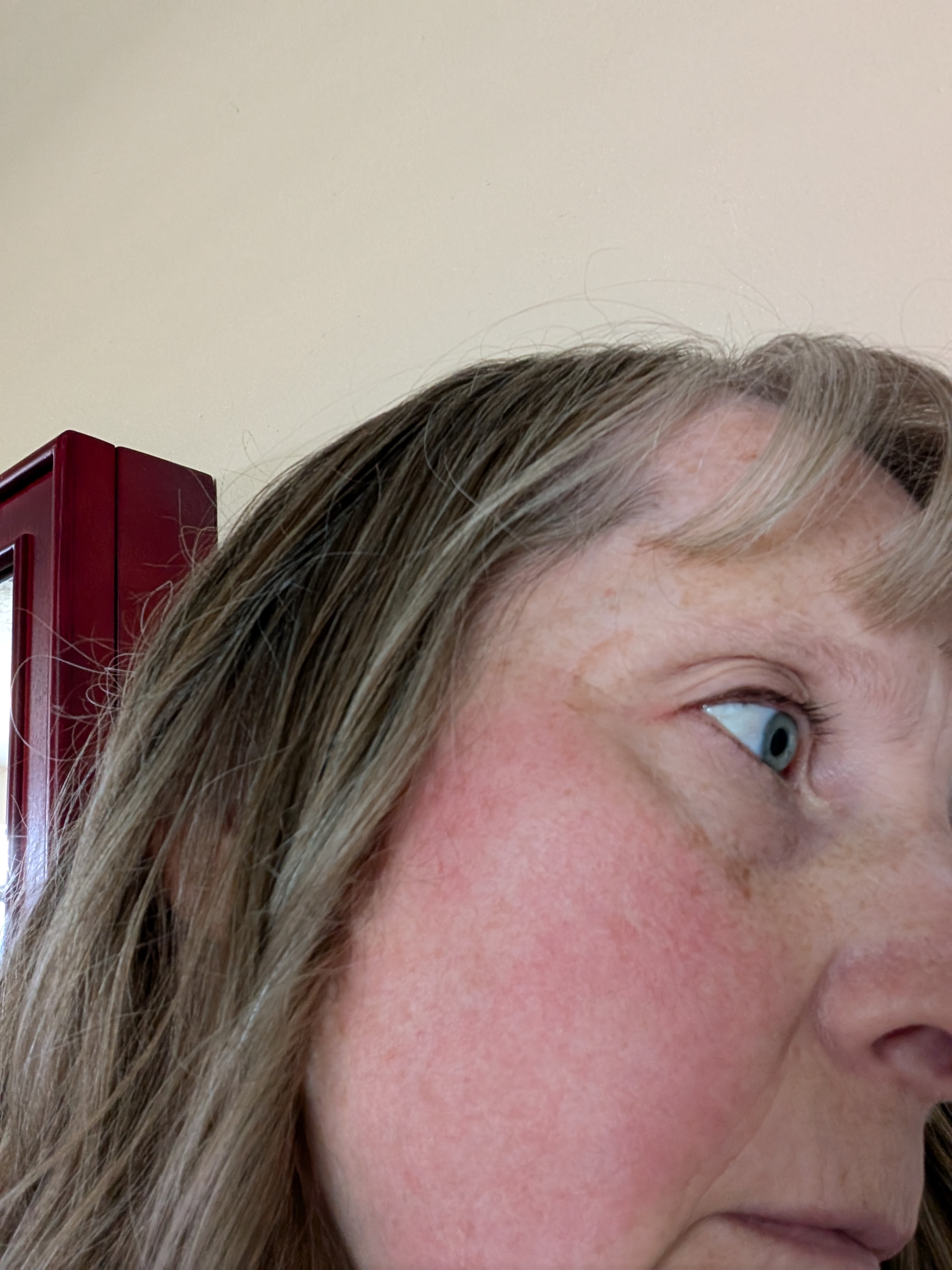 Red, itchy rash