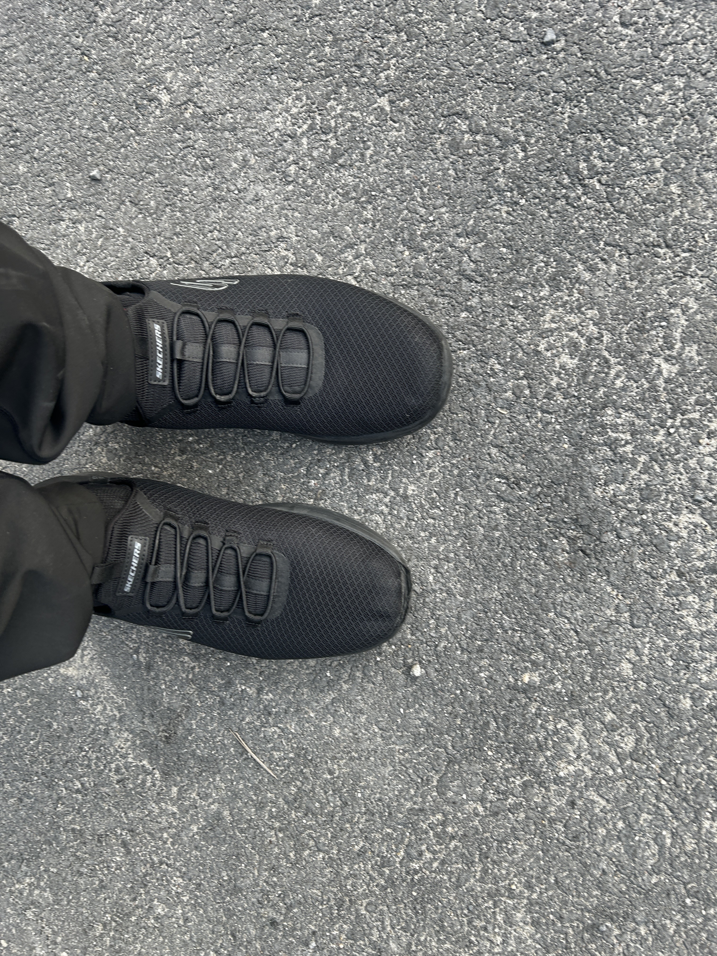 Right toe peeling after One week