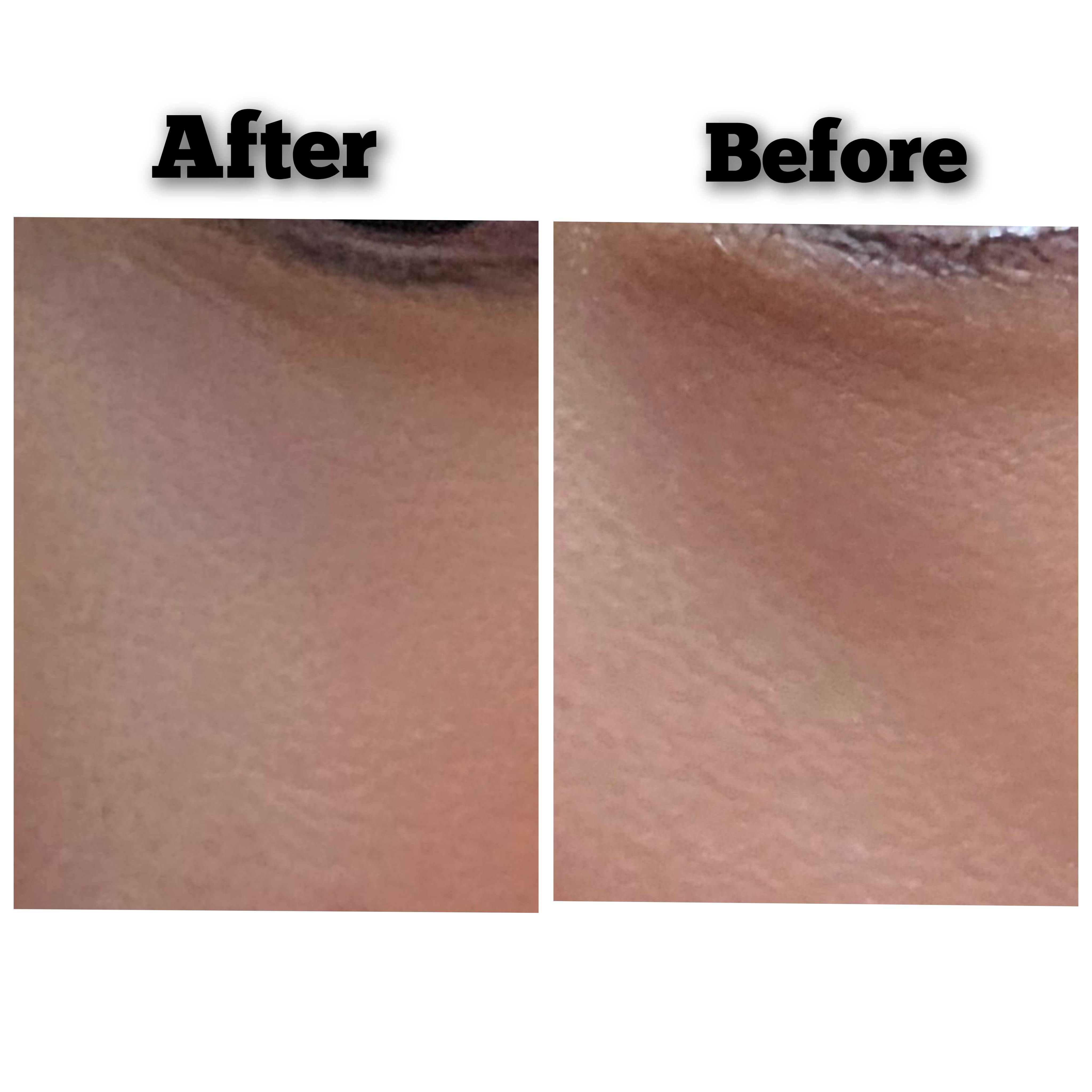 before and after