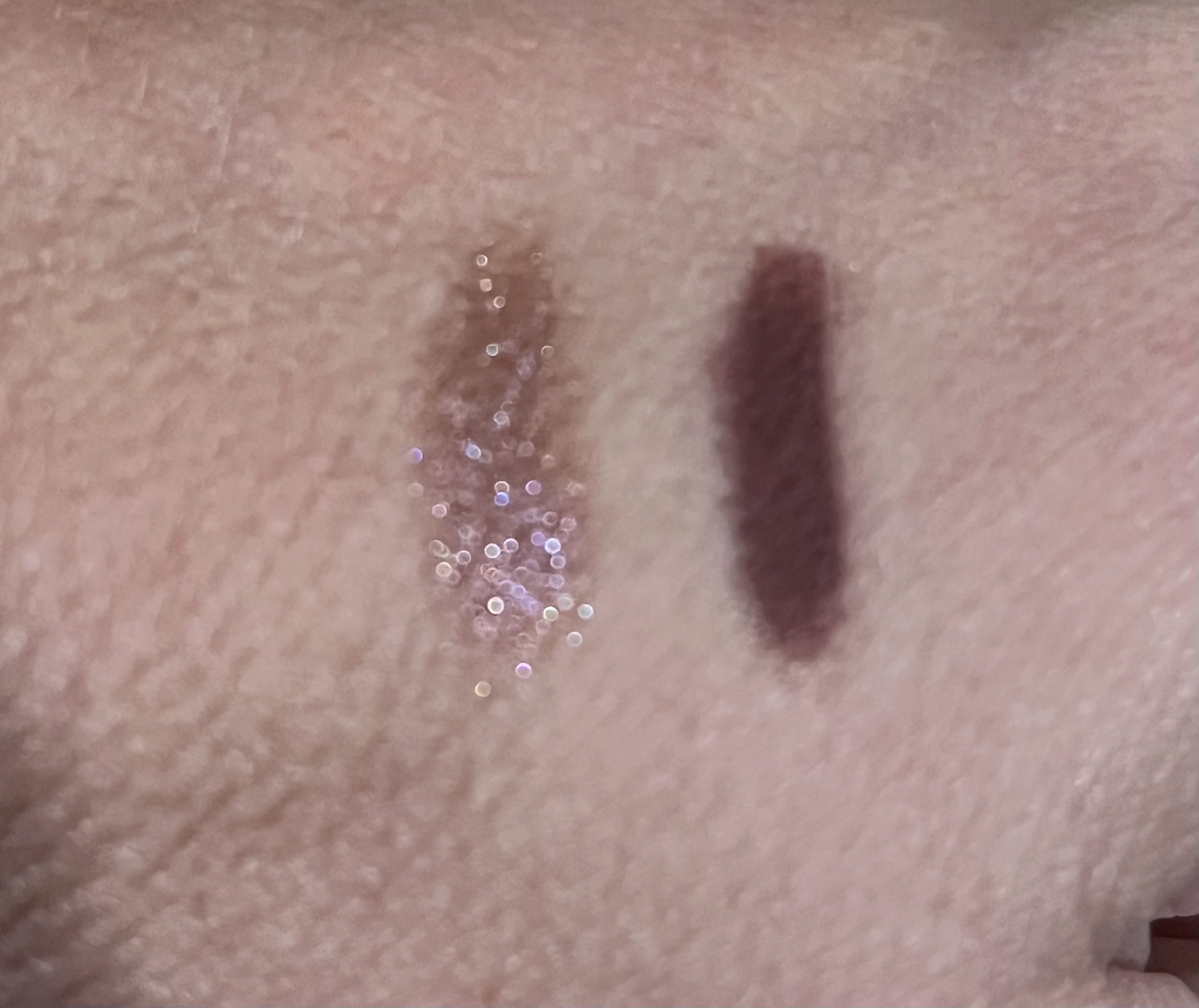 Customer carousel item 11.