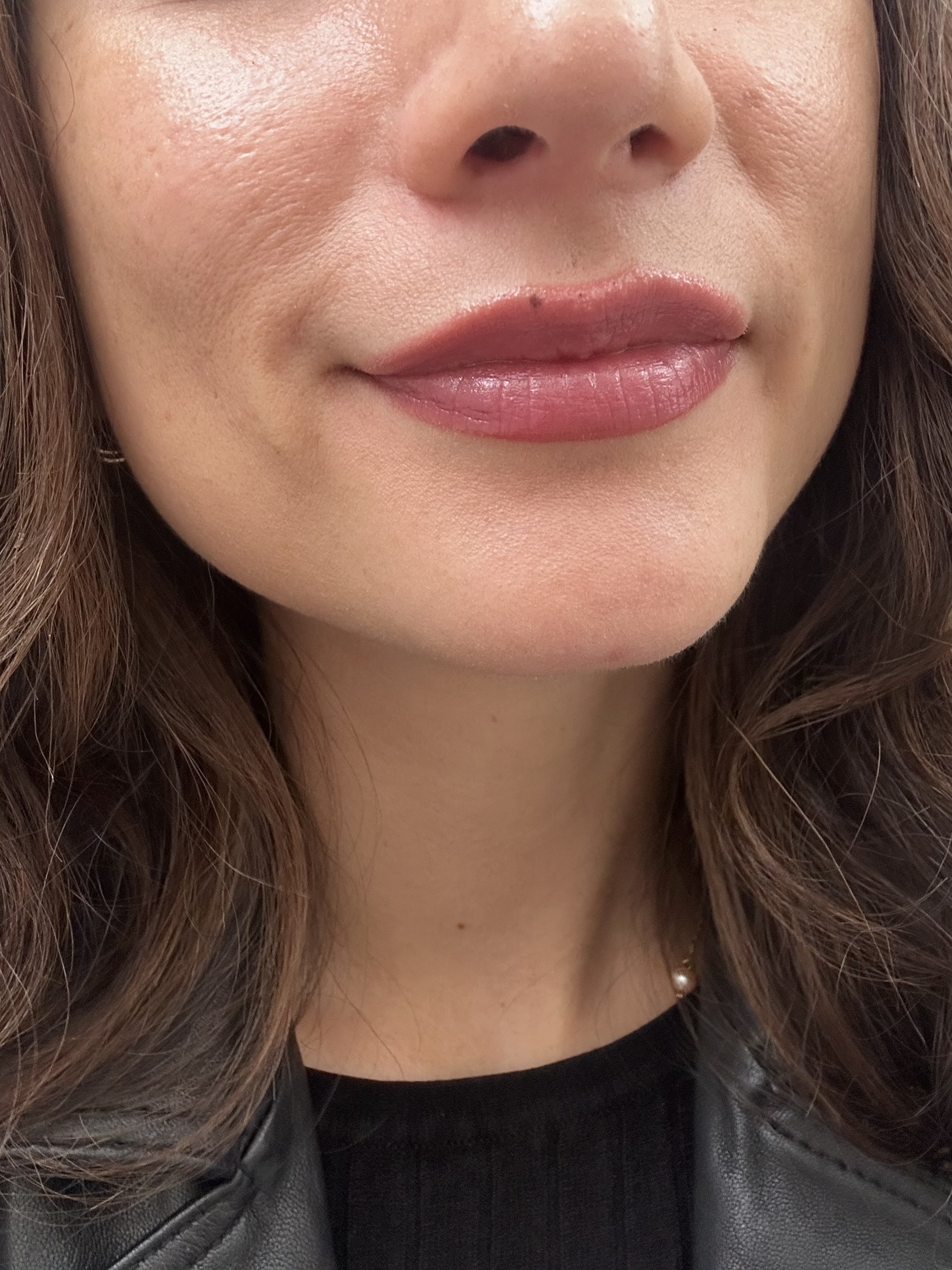 Customer carousel item 11.