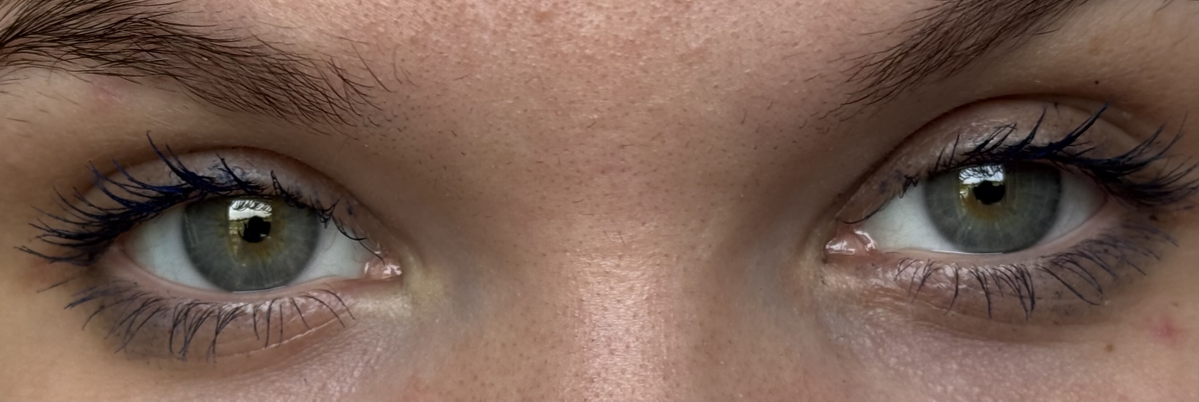 Customer carousel item 11.