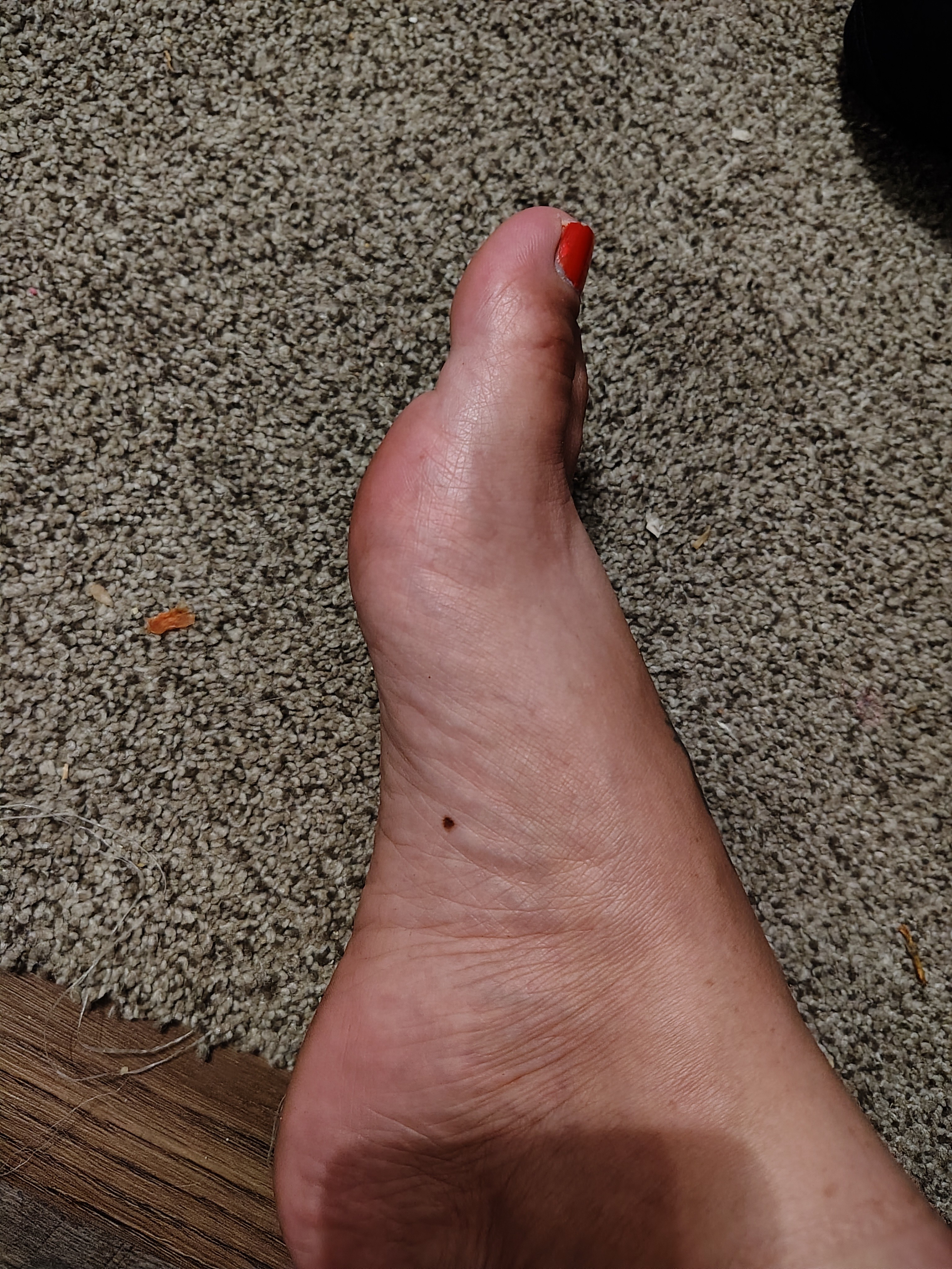 My big toe is bad and feet