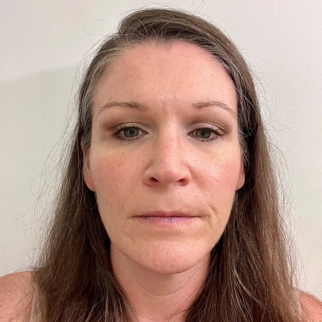 Customer carousel item 11.