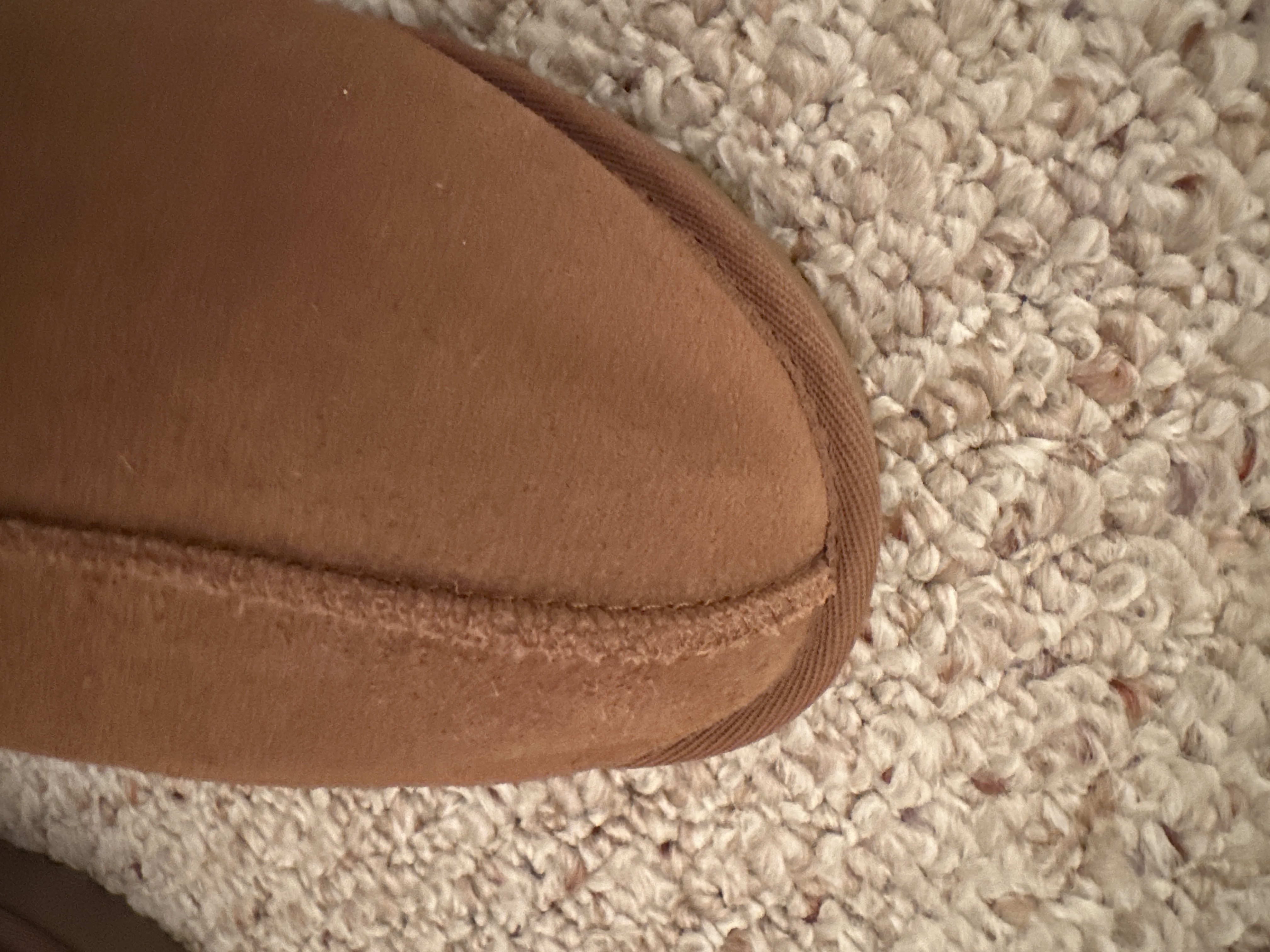 left shoe dark spot is buckling