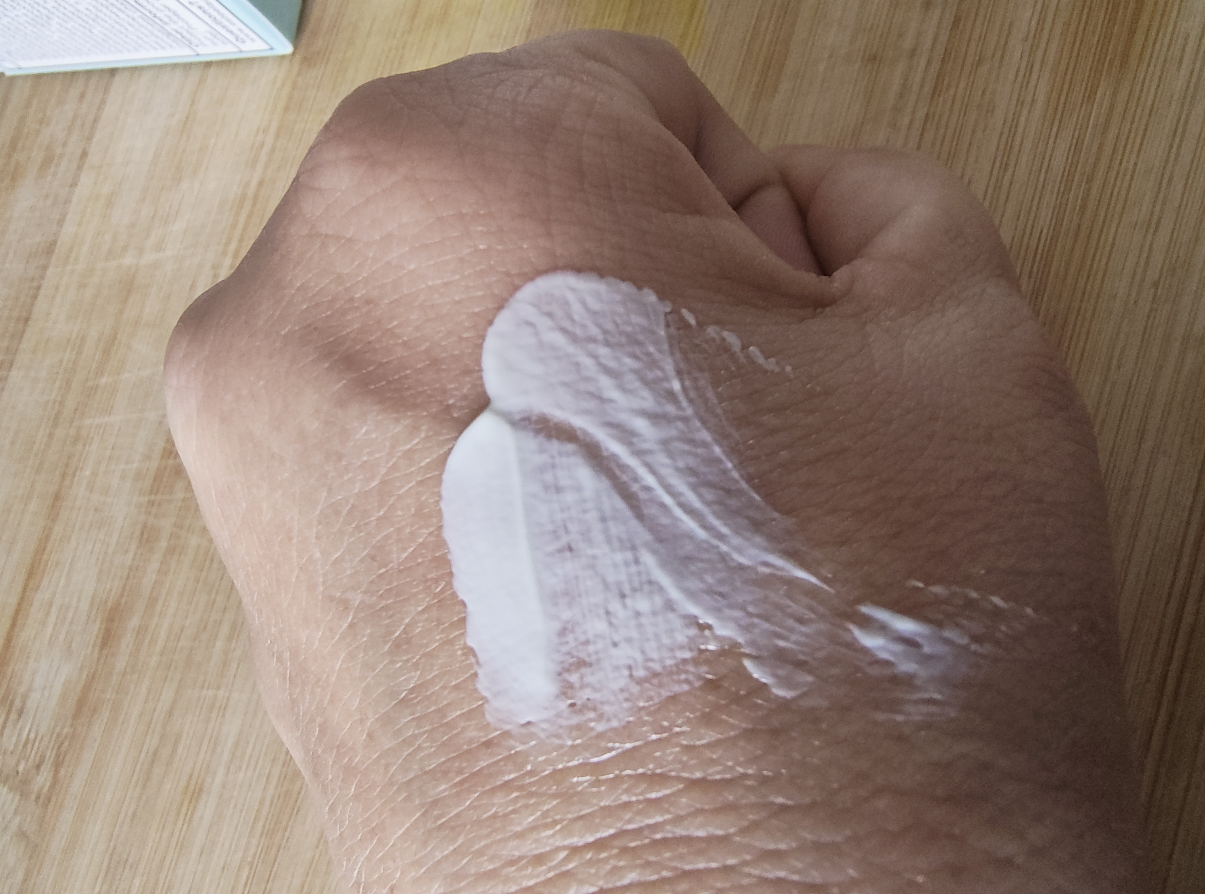 On my hand because it's been very cold and dry